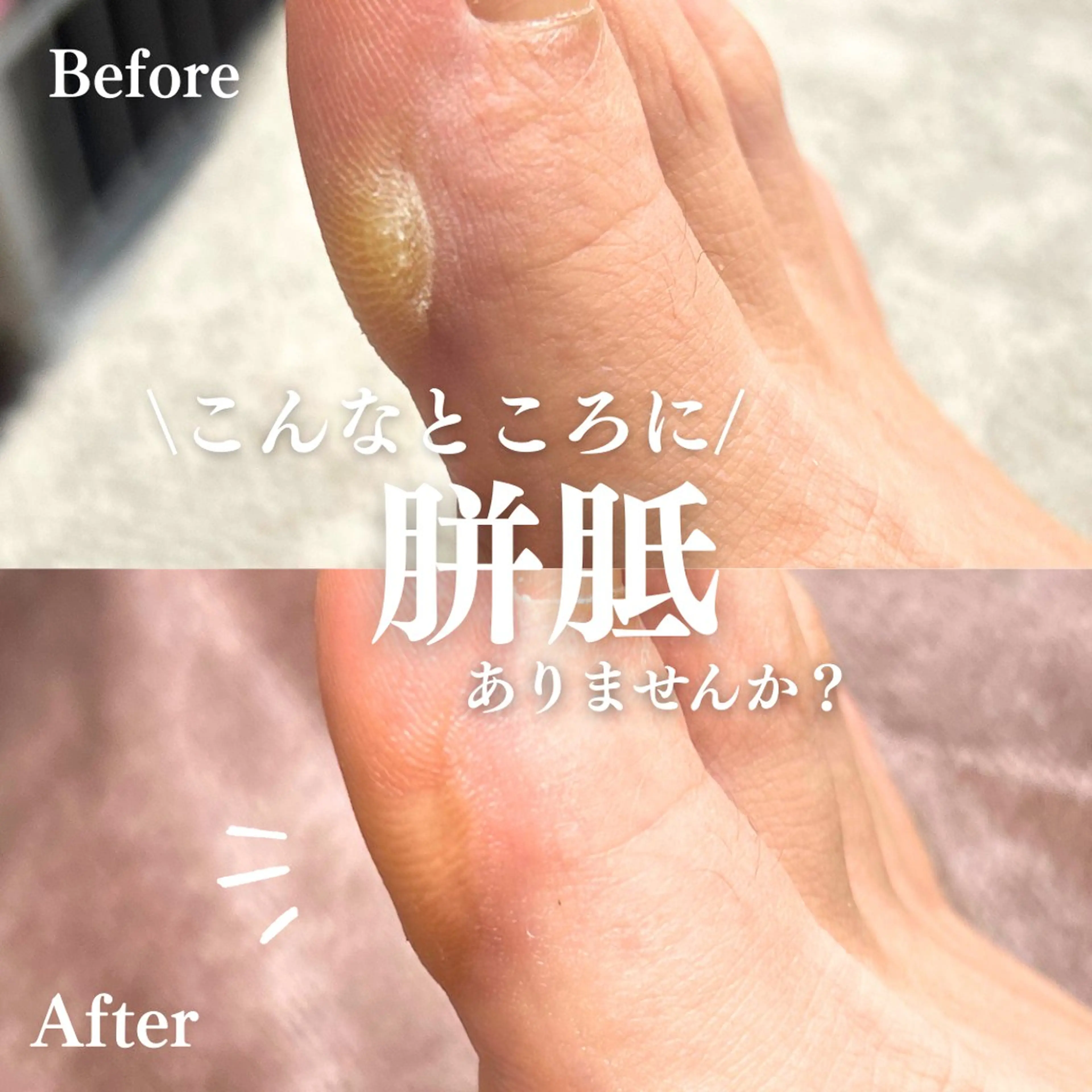 Foot Care Salon Coco 拝島店所属・Foot Salon -Coco-拝島店のエステ・リラクイメージ