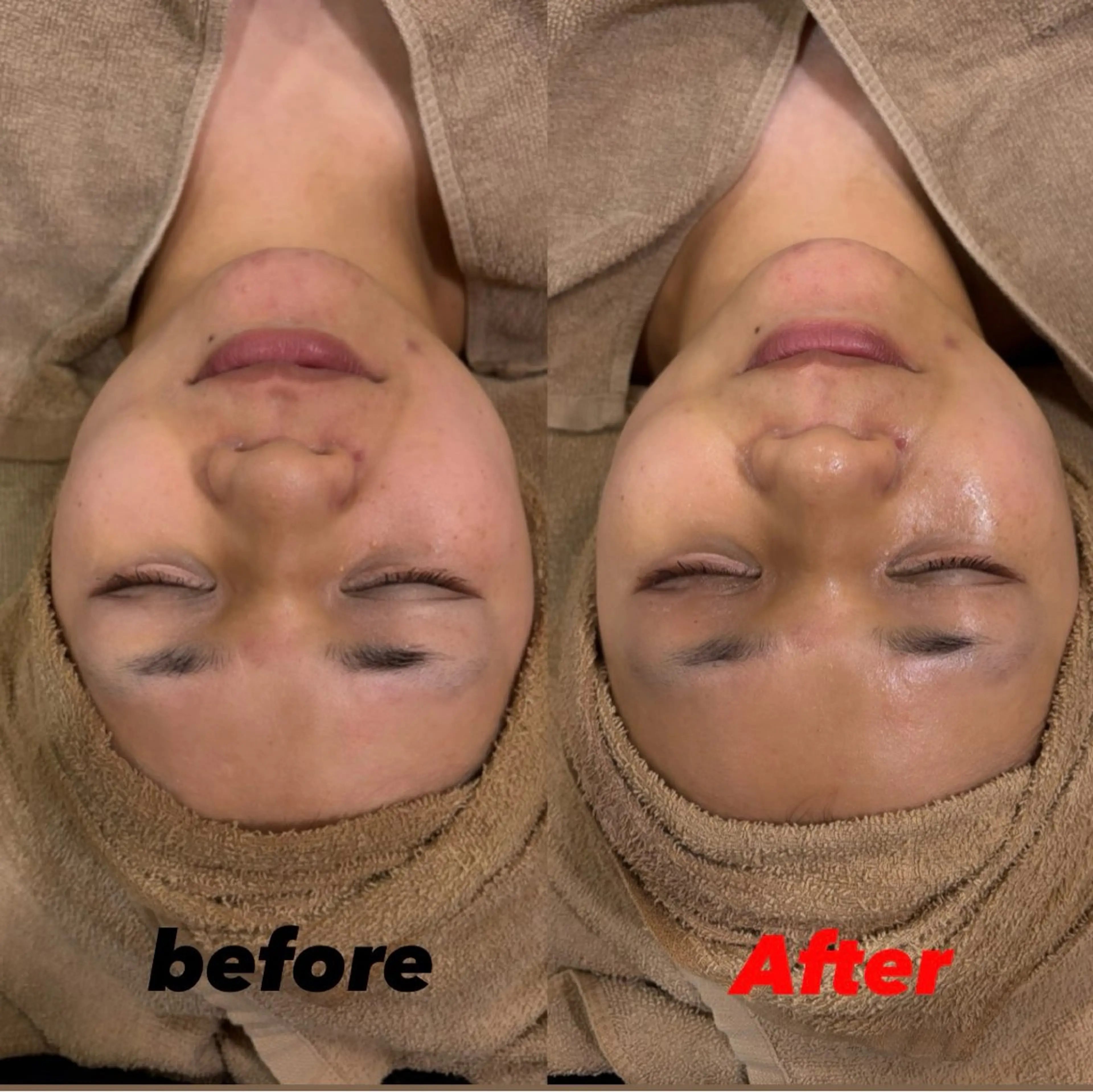 ルリアン　ガーデン所属・大山 彩能のエステ・リラクイメージ