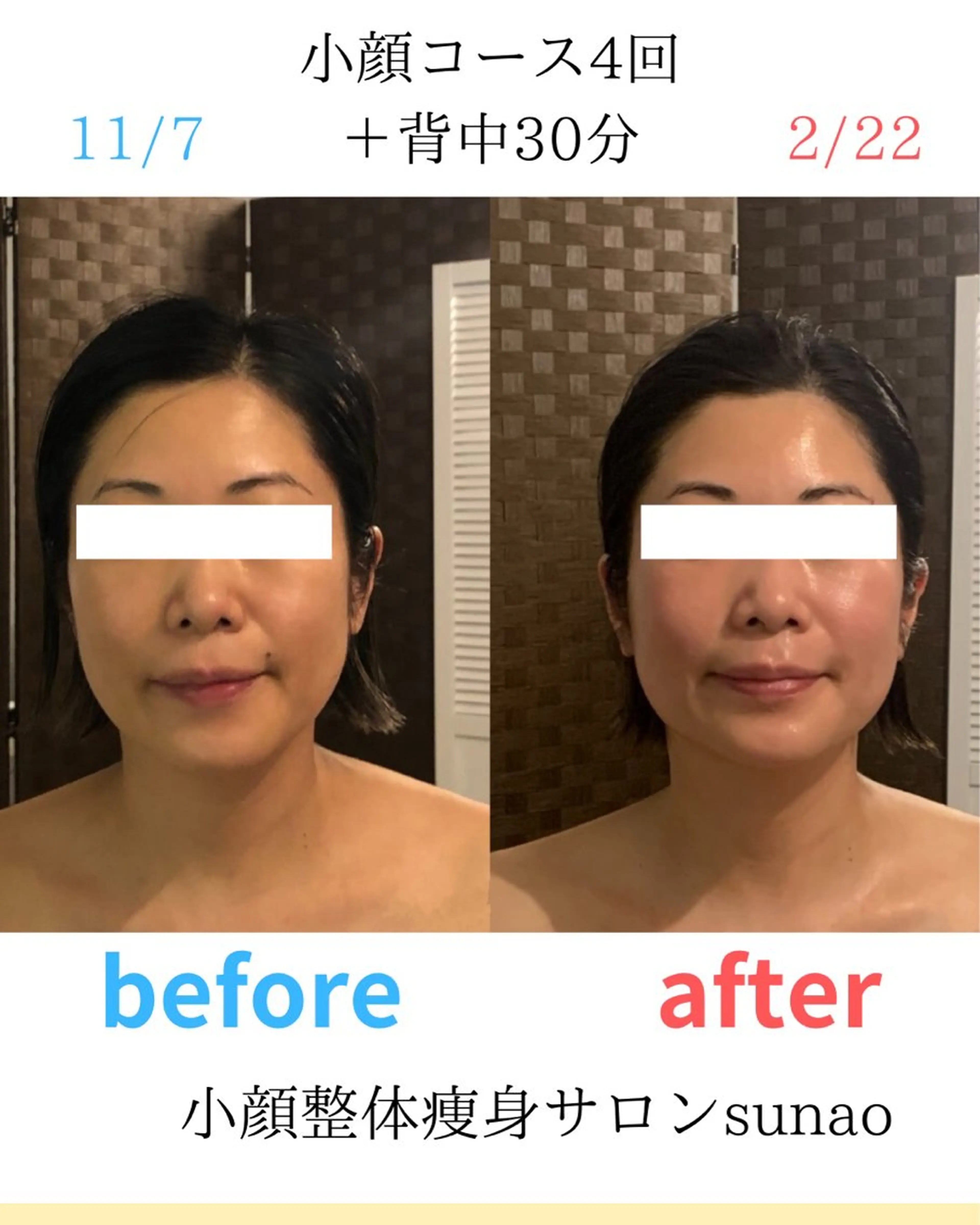 小顔・痩身専門店 Sunao所属・小顔.足痩せ整体 痩身天六Sunaoのその他イメージ