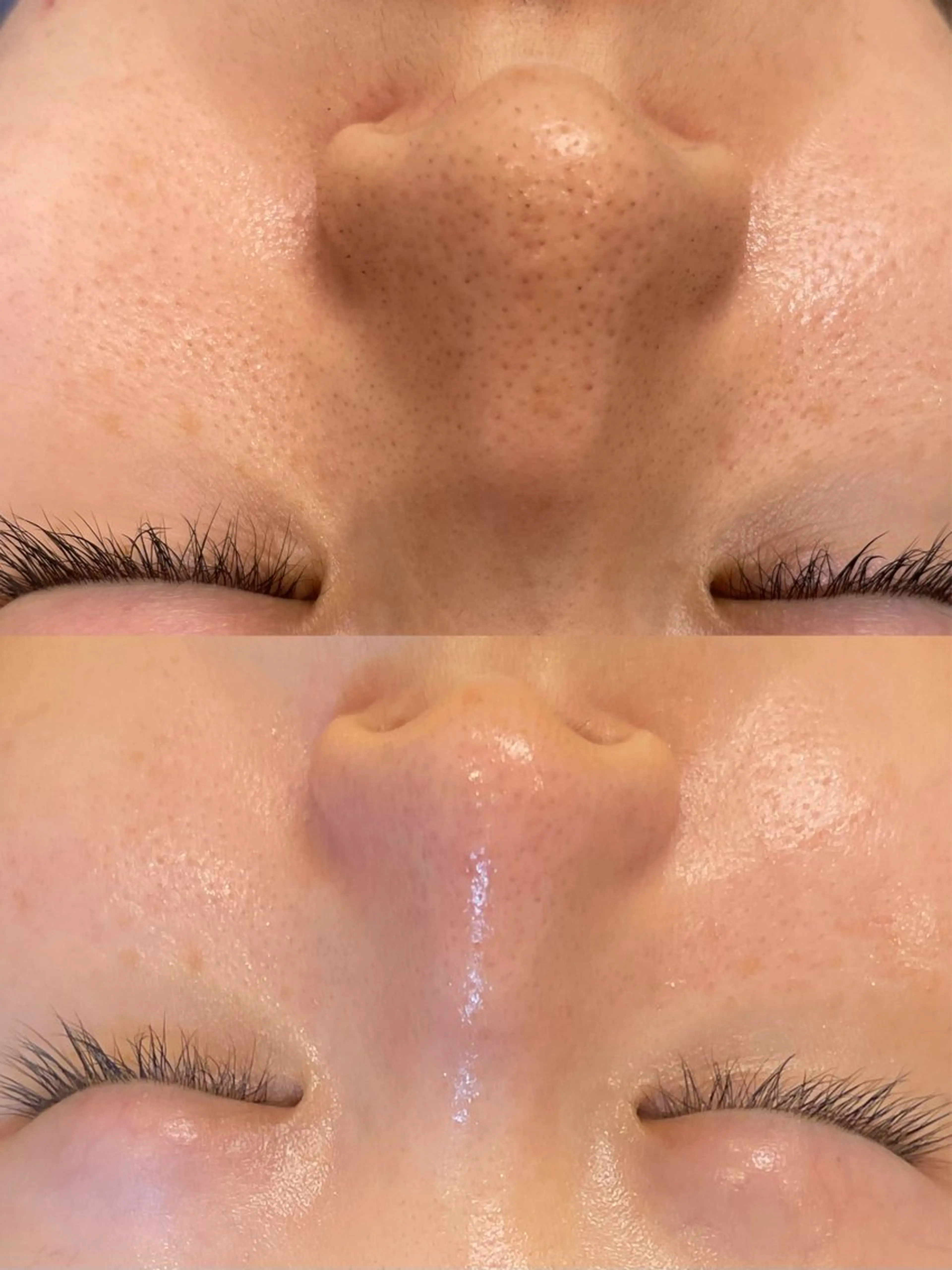 西区九条エステ MITUREIサロンのエステ・リラクイメージ