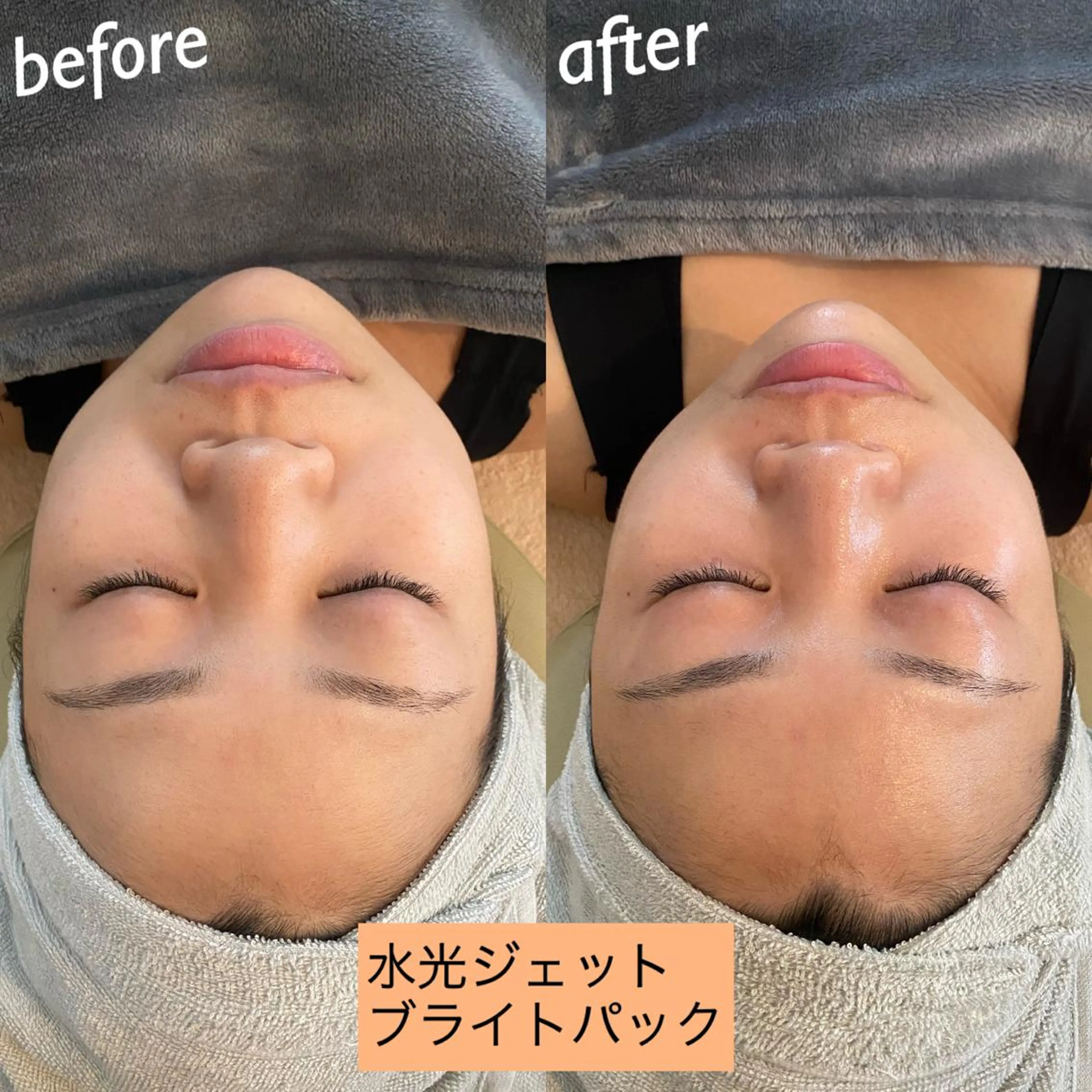 エステ リラク うなじ脱毛/美肌脱毛 LABELのエステ・リラクイメージ