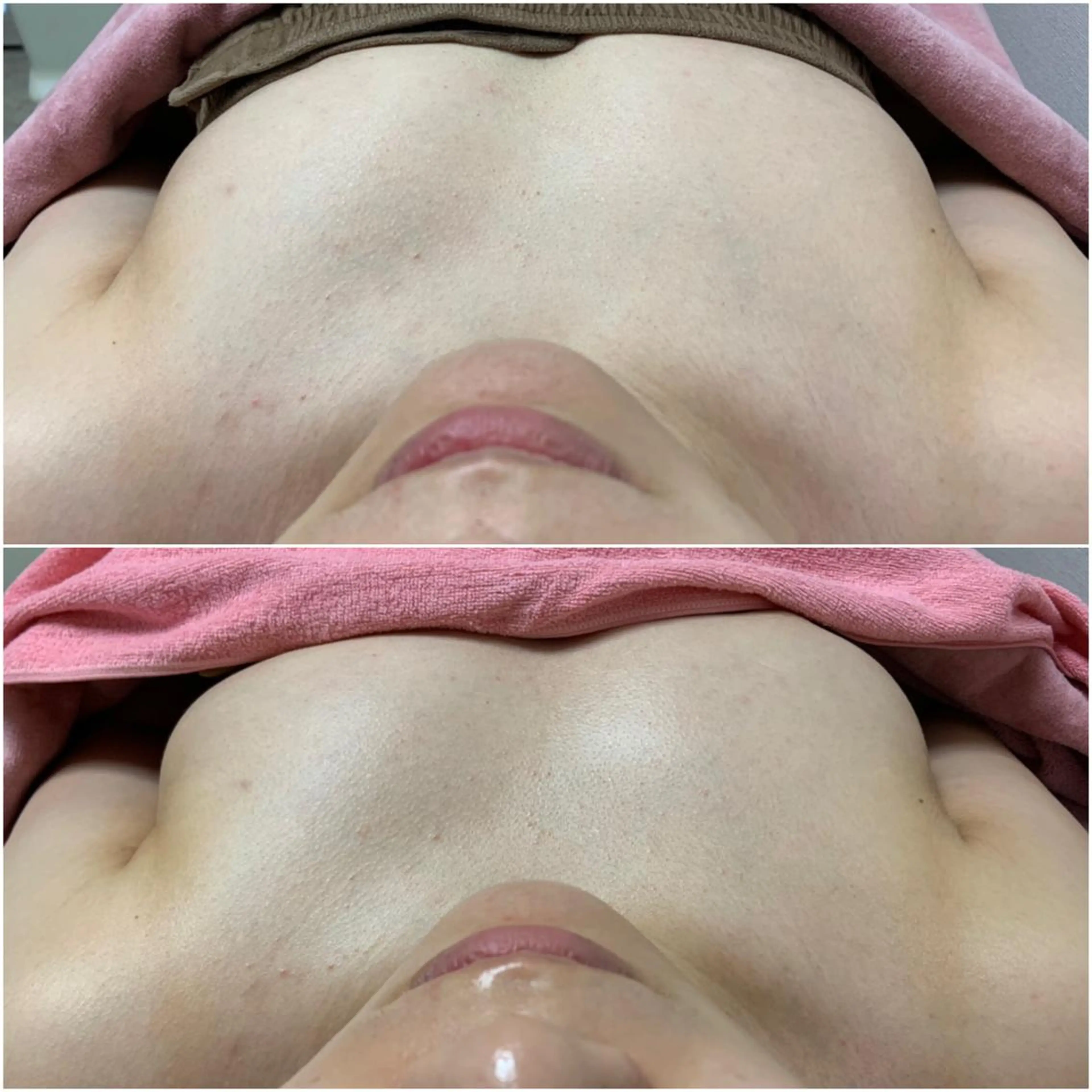 エステ リラク 透明感の肌Lino malieのエステ・リラクイメージ