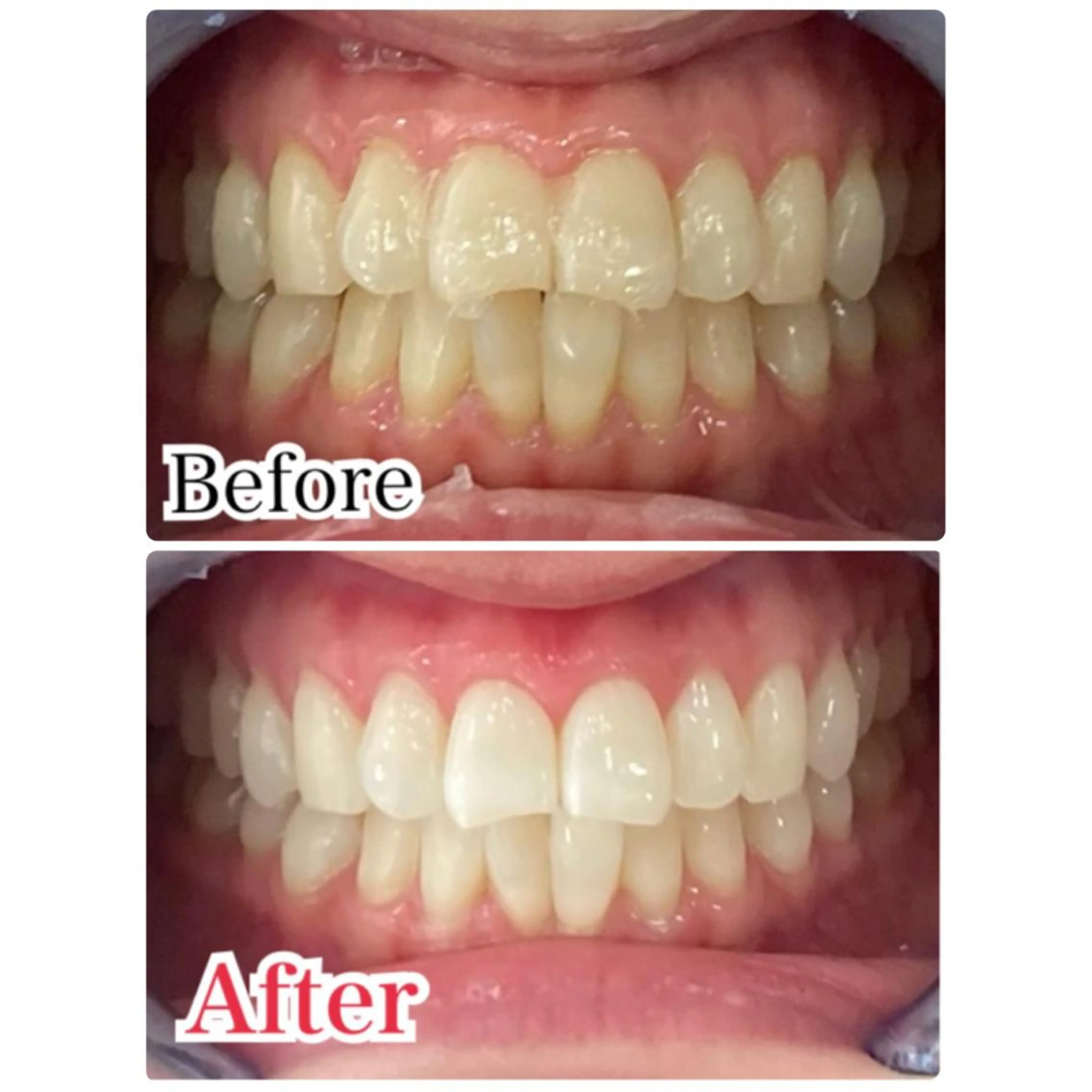 メンズ キッズ プラチナムビューティー柏所属・【歯科提携】柏ホワイ トニングスタイルのその他イメージ