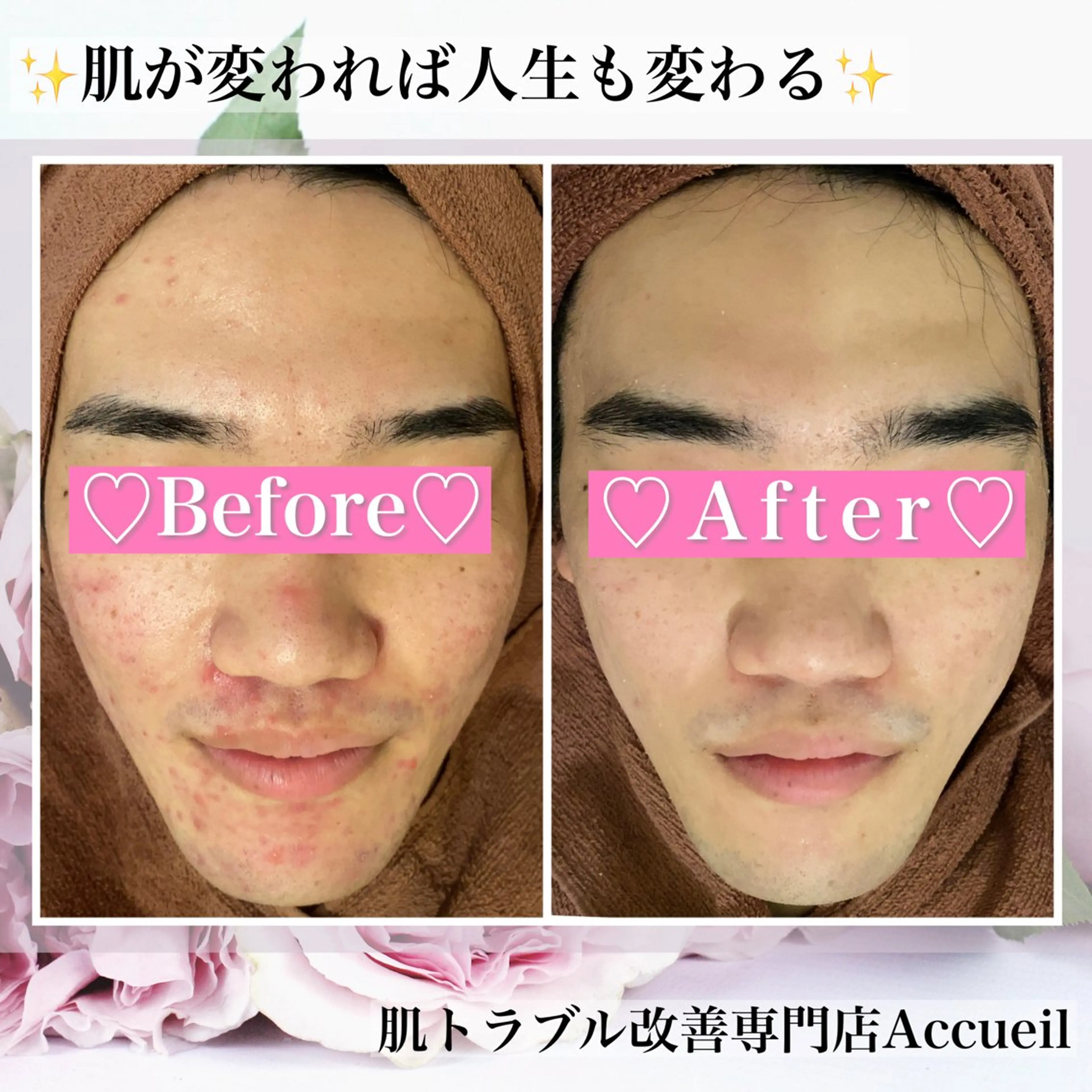 エステ リラク ニキビ・肌質改善専門 ♡人生が変わるサロンのエステ・リラクイメージ