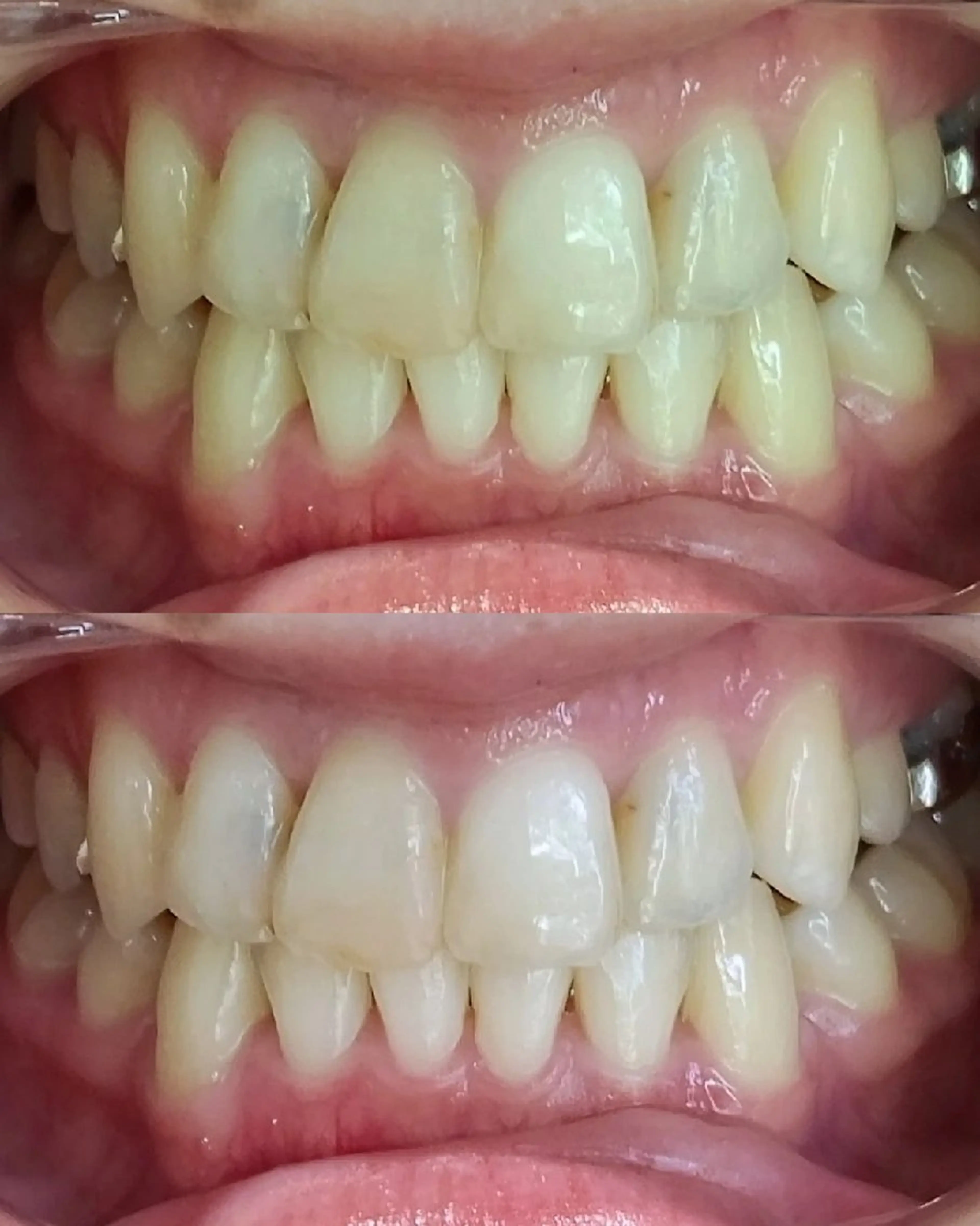 coco whitening&Beauty所属・阿部 香織のエステ・リラクイメージ