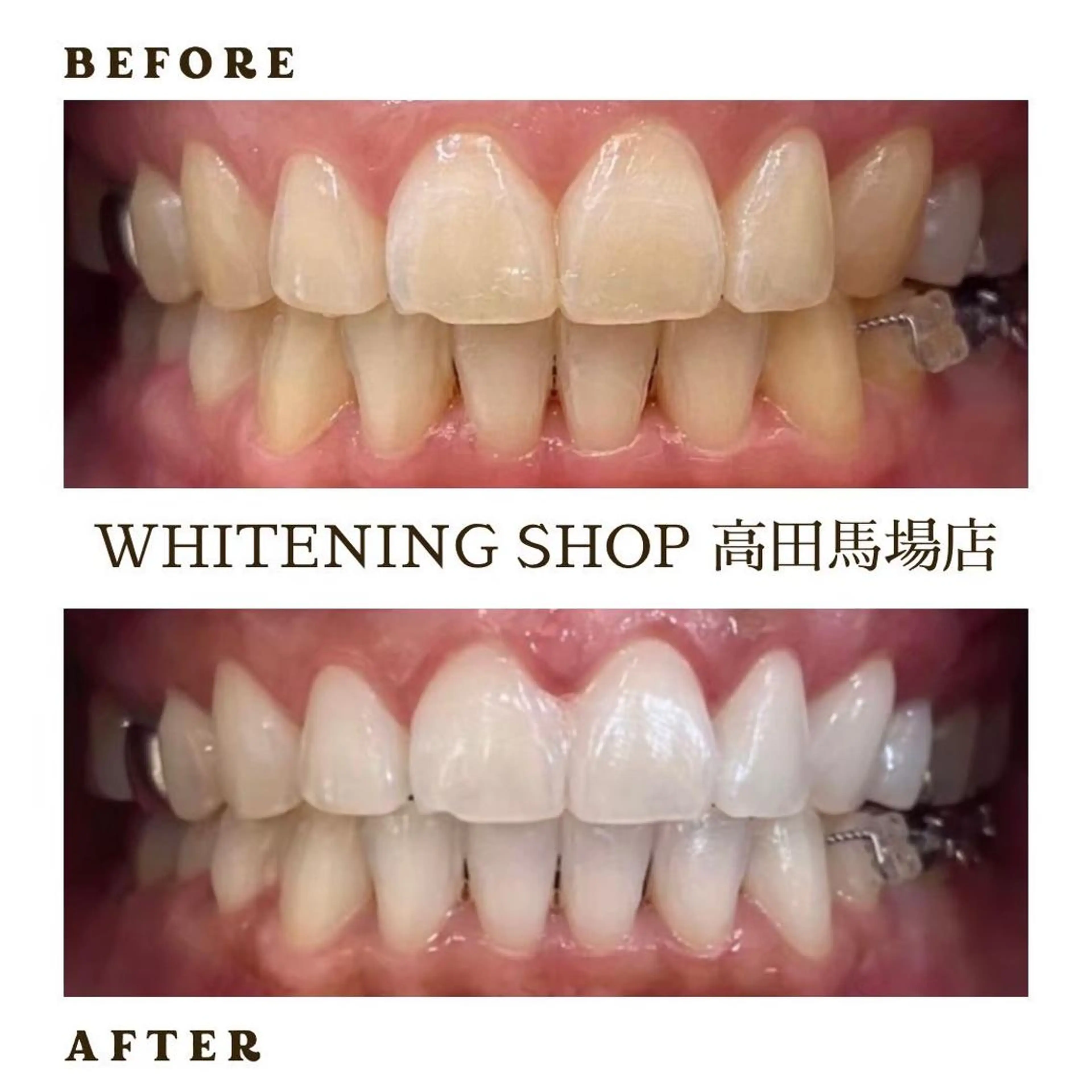 メンズ その他 ホワイトニング ショップ高田馬場店のその他イメージ