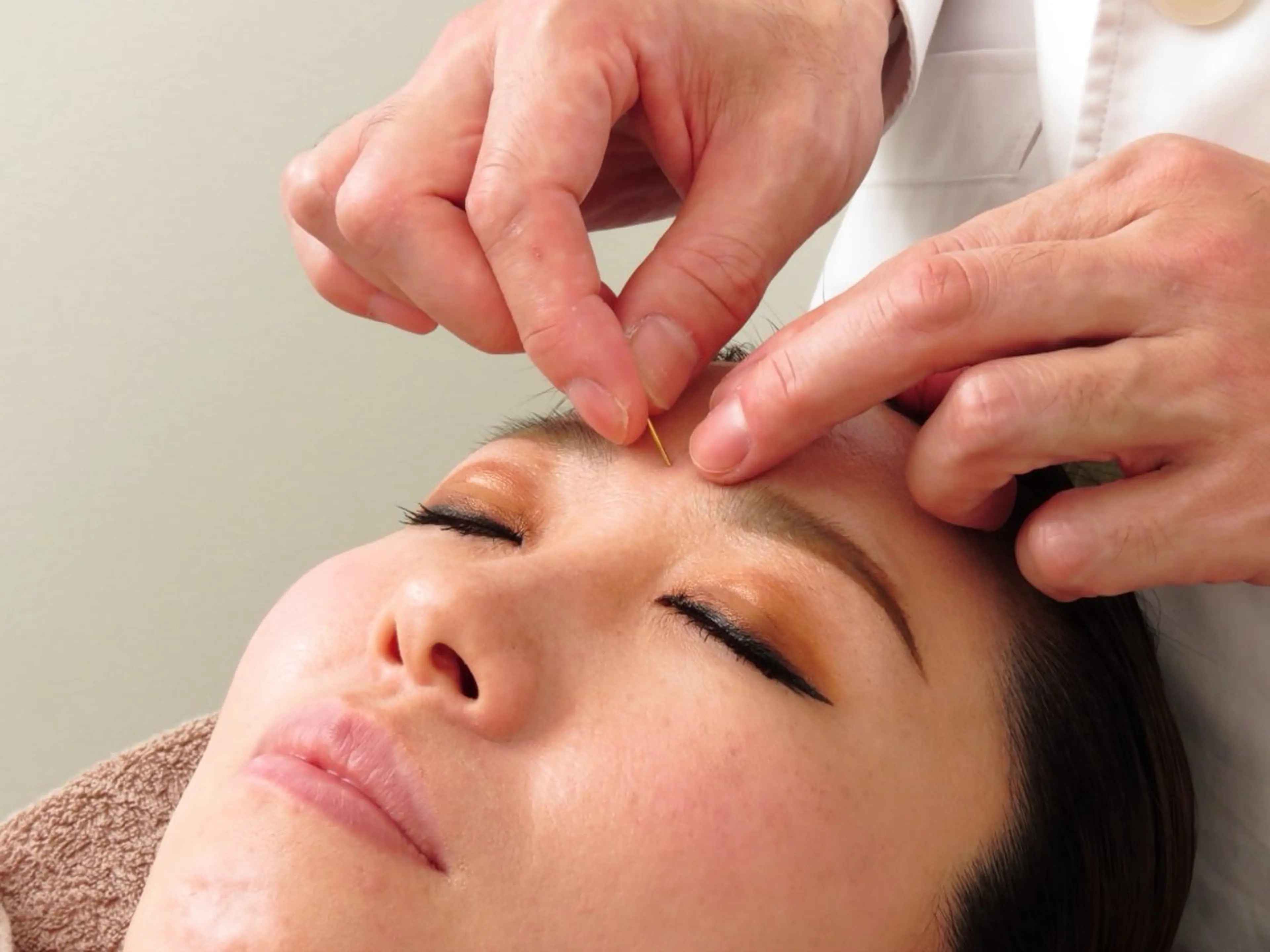 刺さない美顔鍼〜アキュフェイス〜の写真