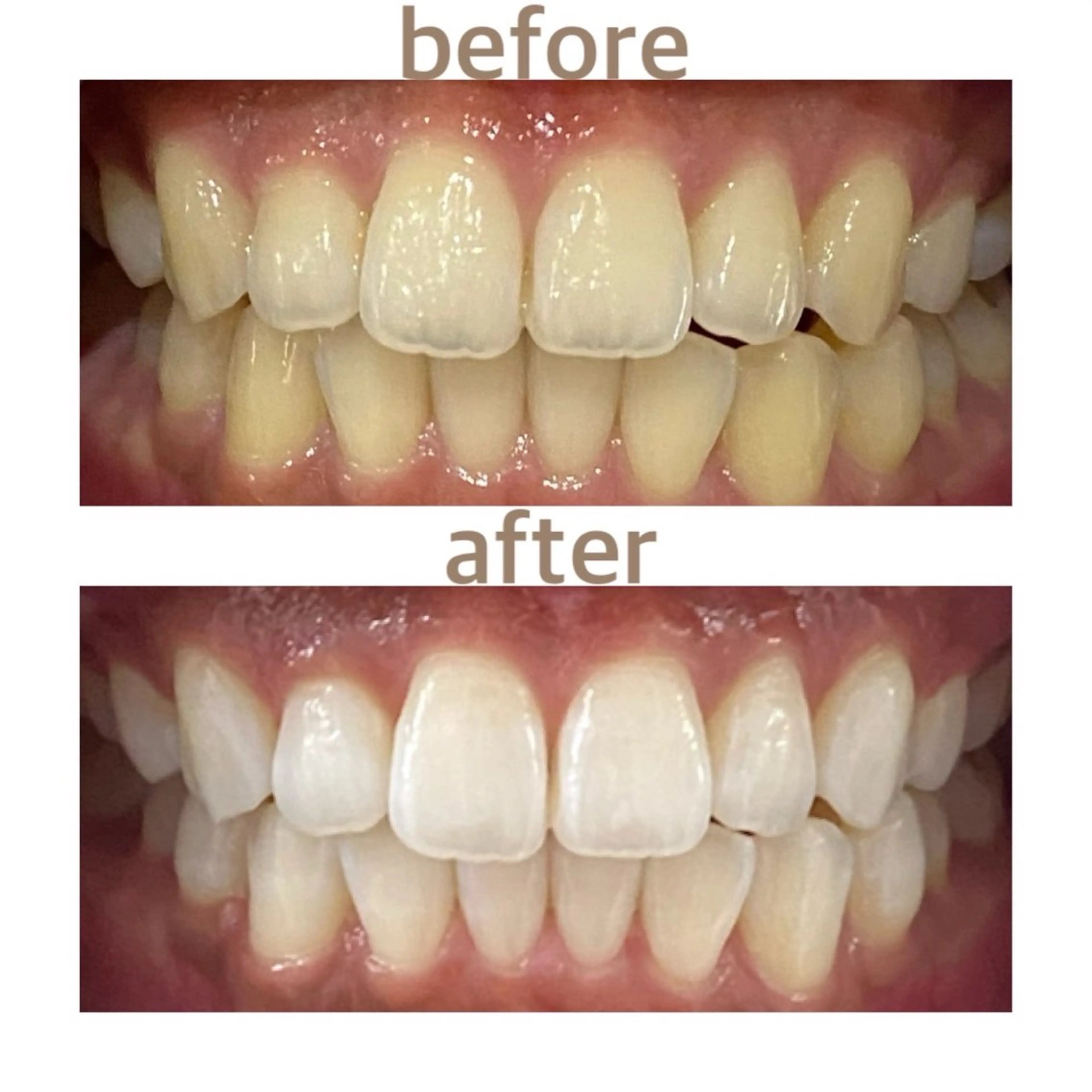 メンズ ホワイトニング ショップ本八幡店のエステ・リラクイメージ