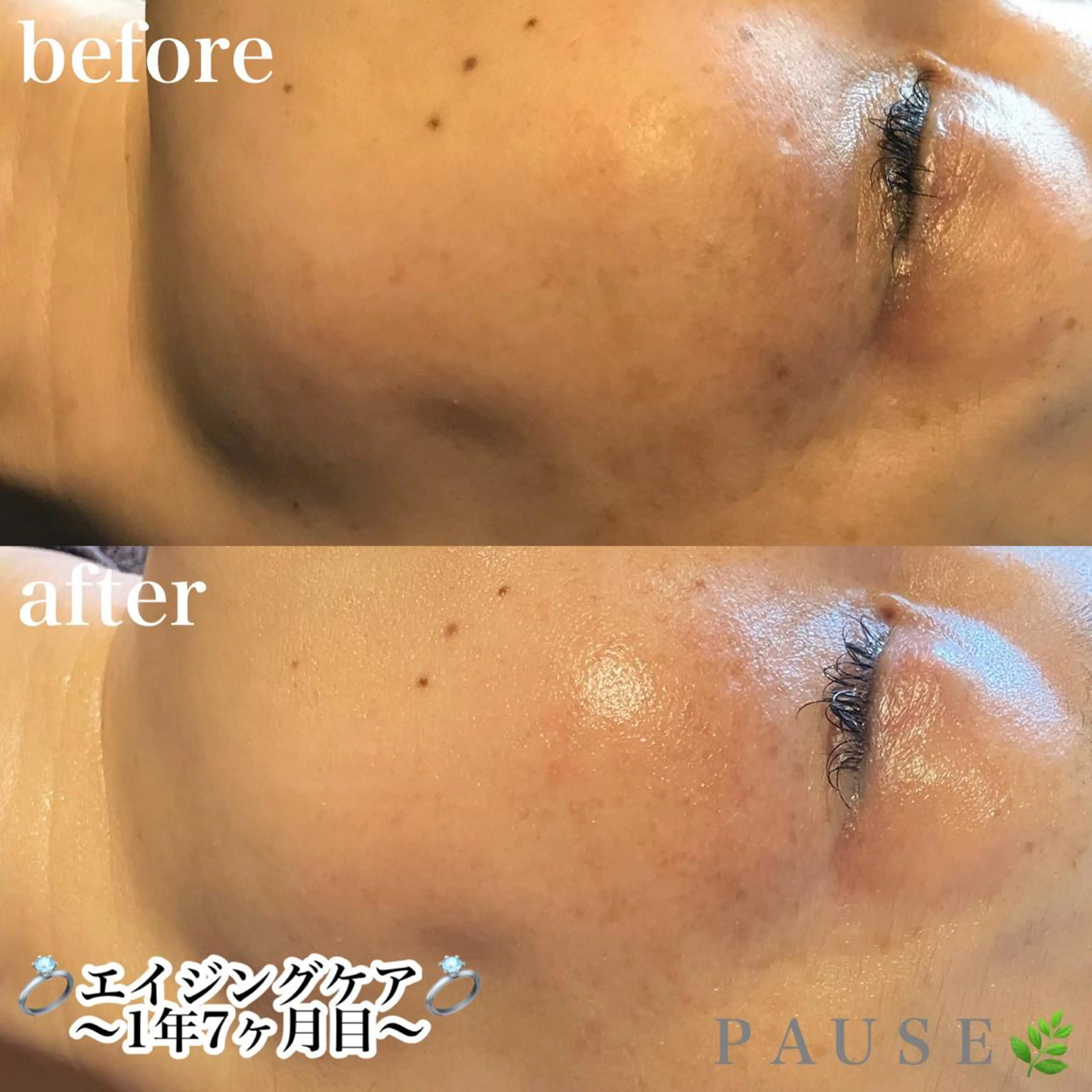 エステ リラク 浜野 恵美のエステ・リラクイメージ