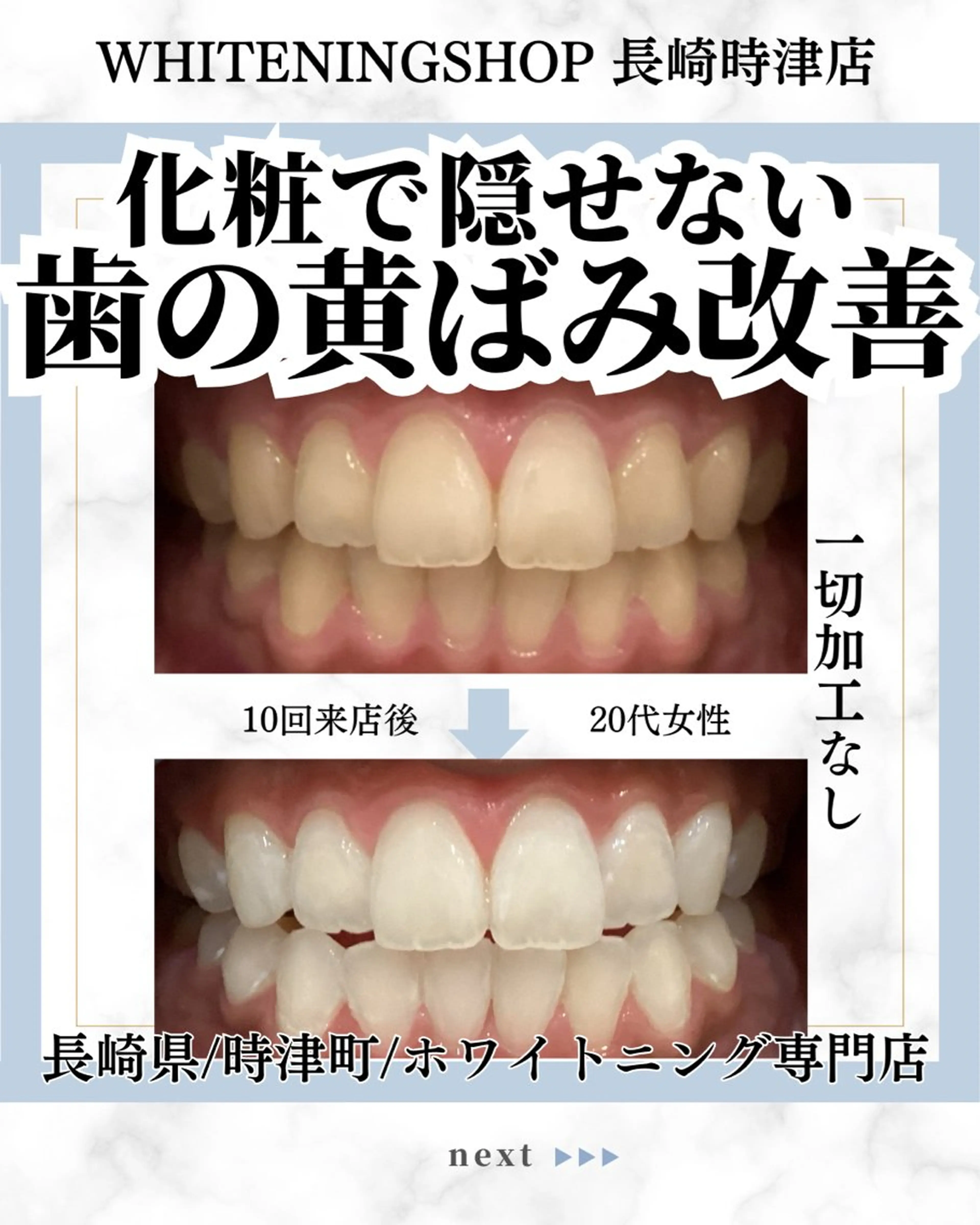 ホワイトニングショップ時津店所属・ホワイトニング ショップ長崎時津店のその他イメージ