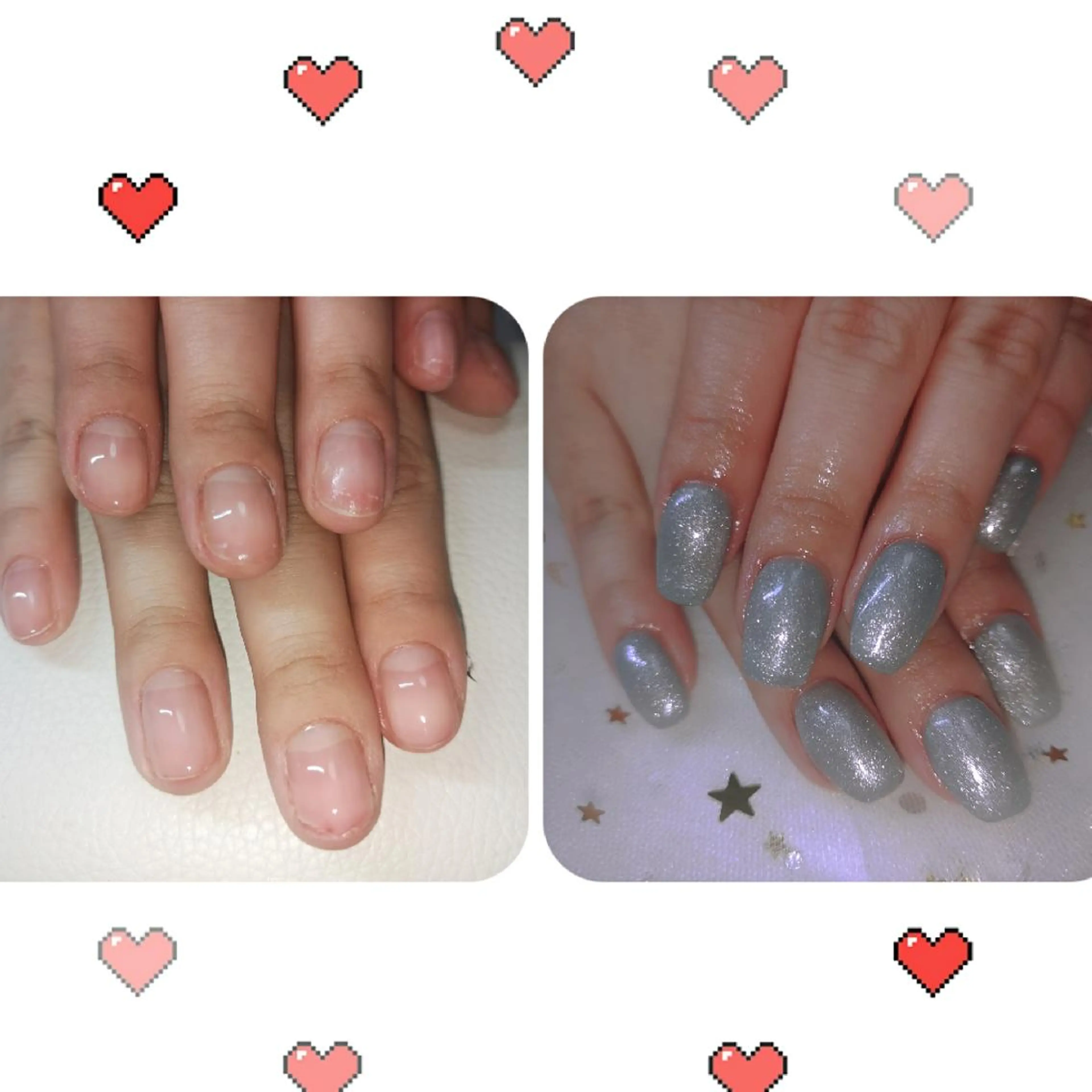 ミディアム ネイル ネイリストゆか💅 長さだし、深爪矯正のネイルデザイン