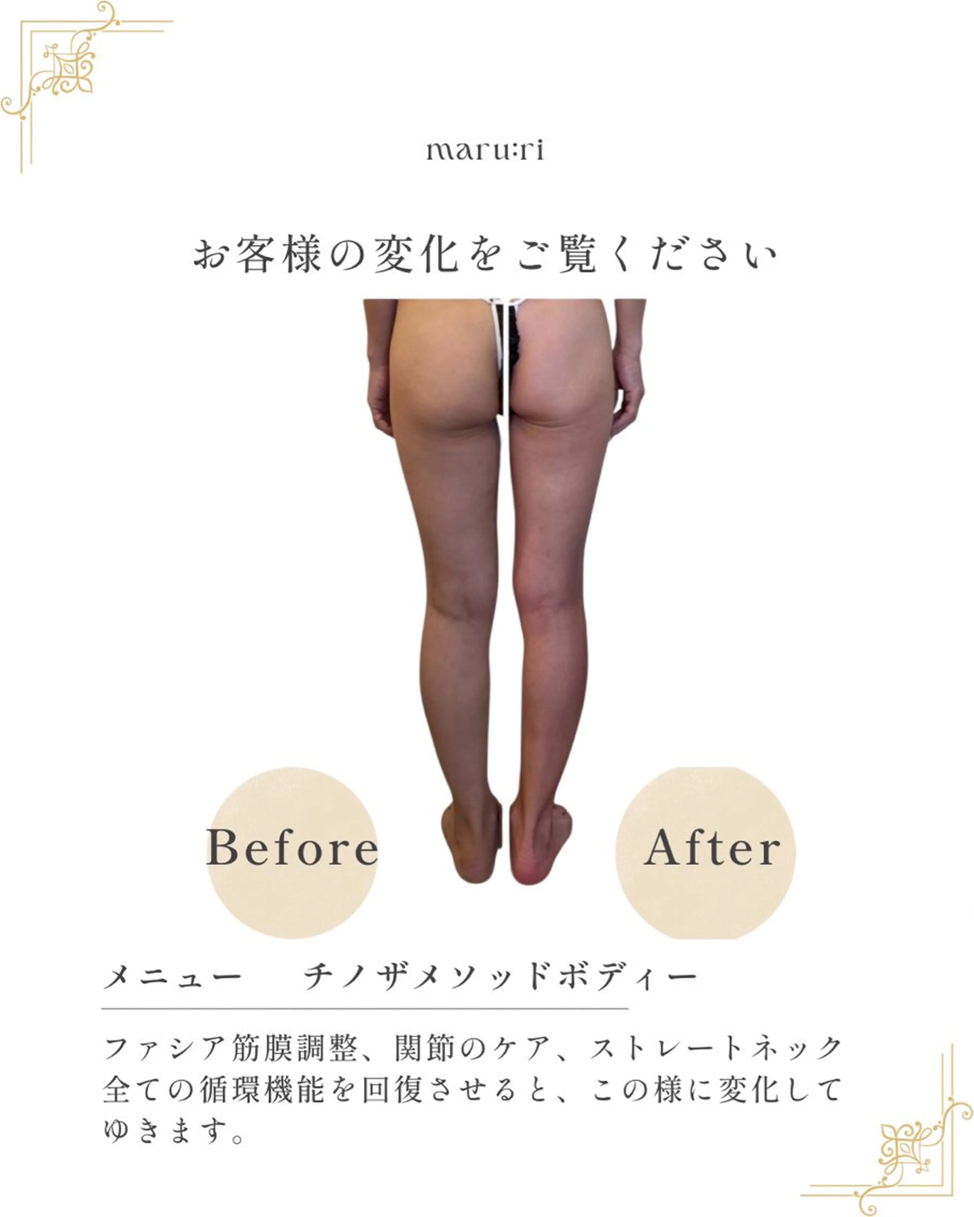 chino themethod(チノザメソッド)美骨矯正ボディーコースの写真