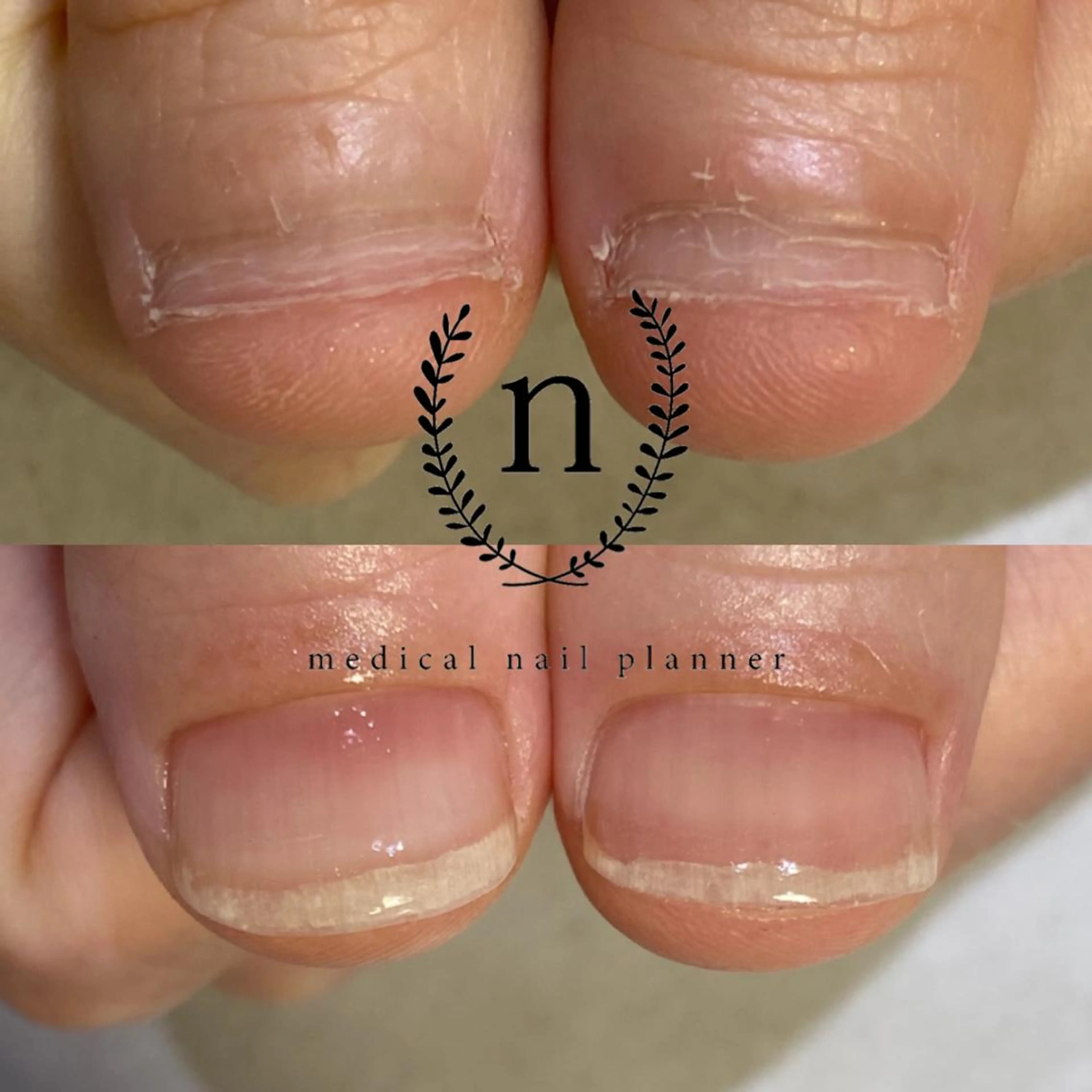 ネイル Rio 𓍼のネイルデザイン