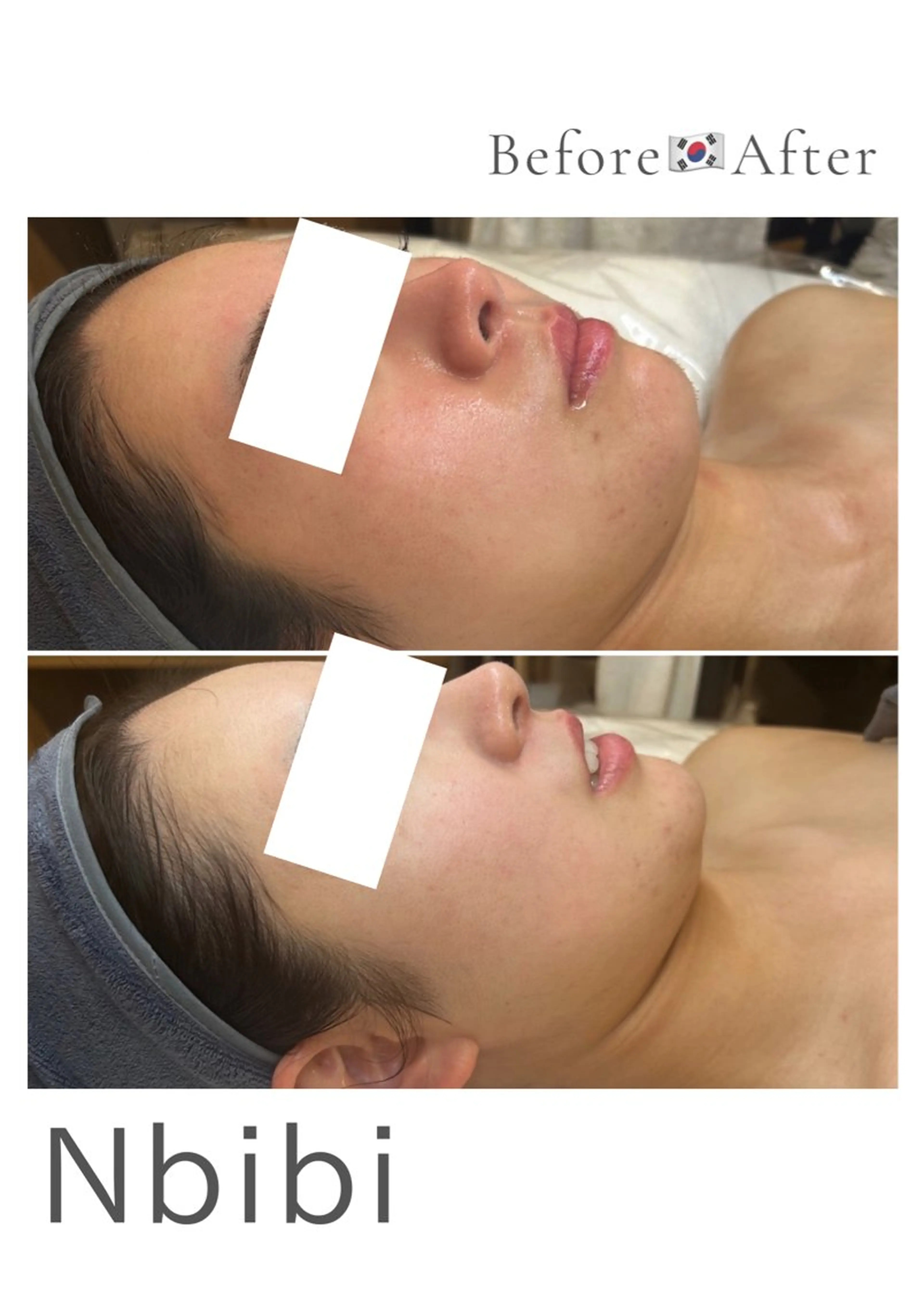 韓国🇰🇷価格 サロン_Nbibiのエステ・リラクイメージ