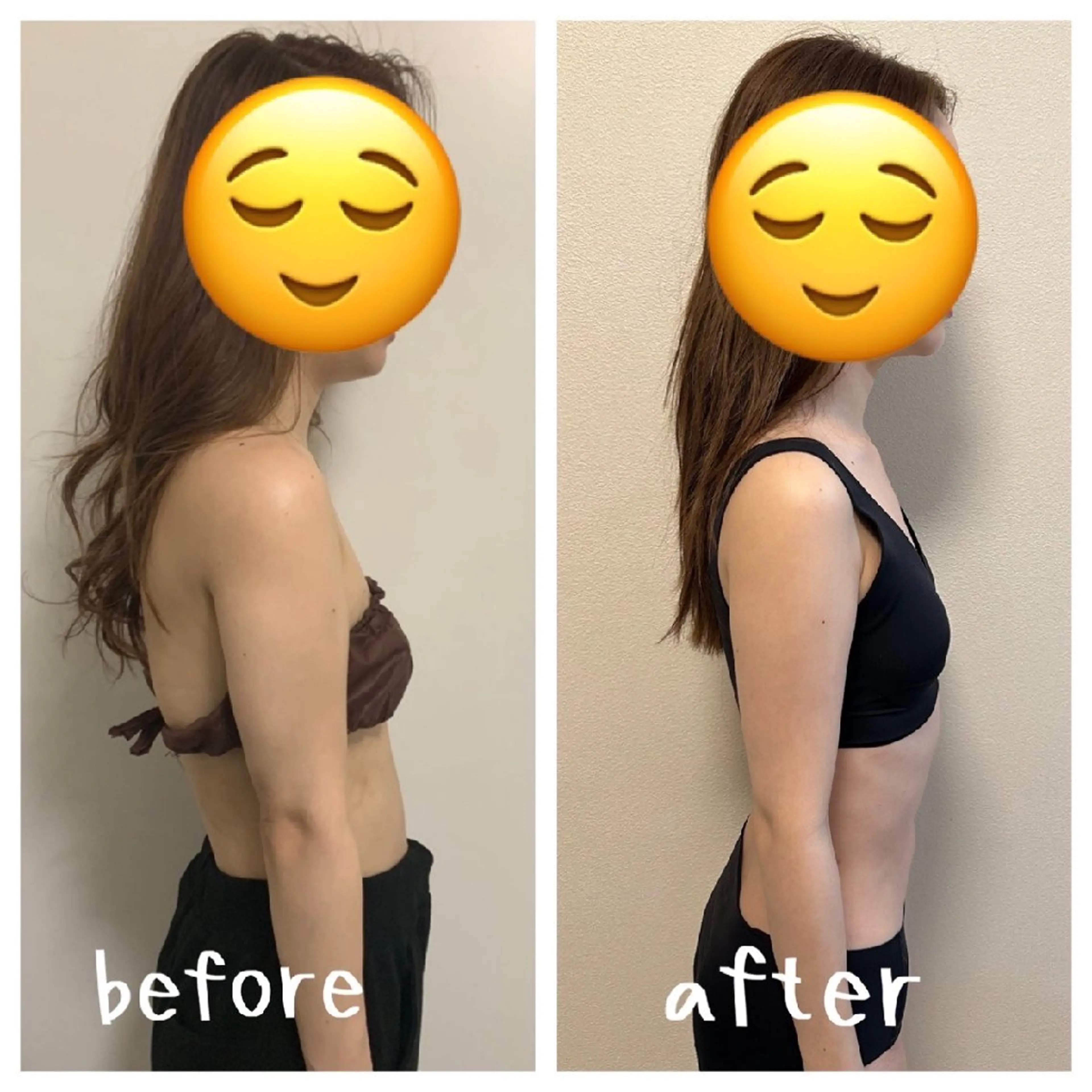 【根本改善/姿勢美人に】小顔矯正×姿勢矯正💆‍♀️の写真