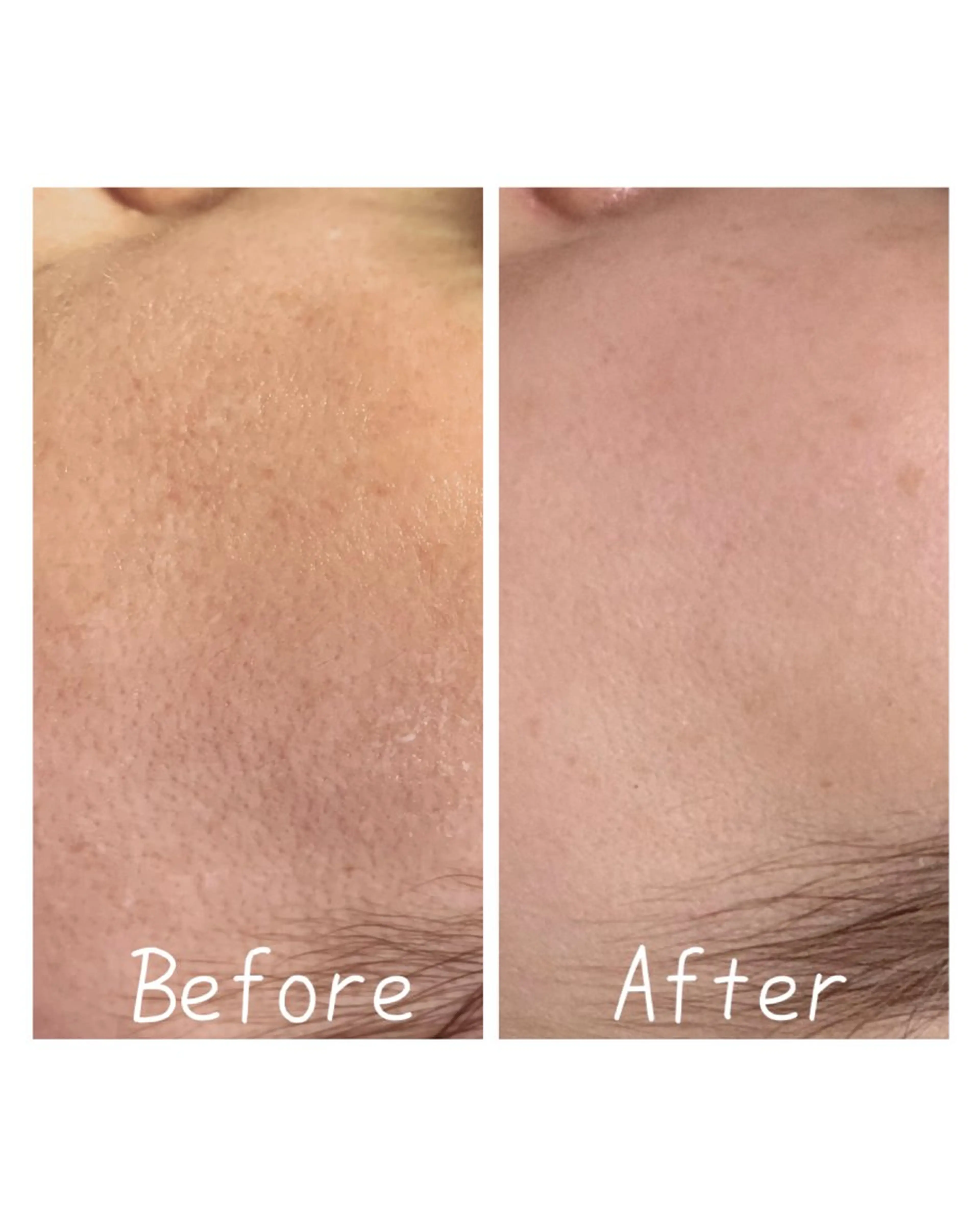 エステ 肌質改善Charme coco  増毛のエステ・リラクイメージ