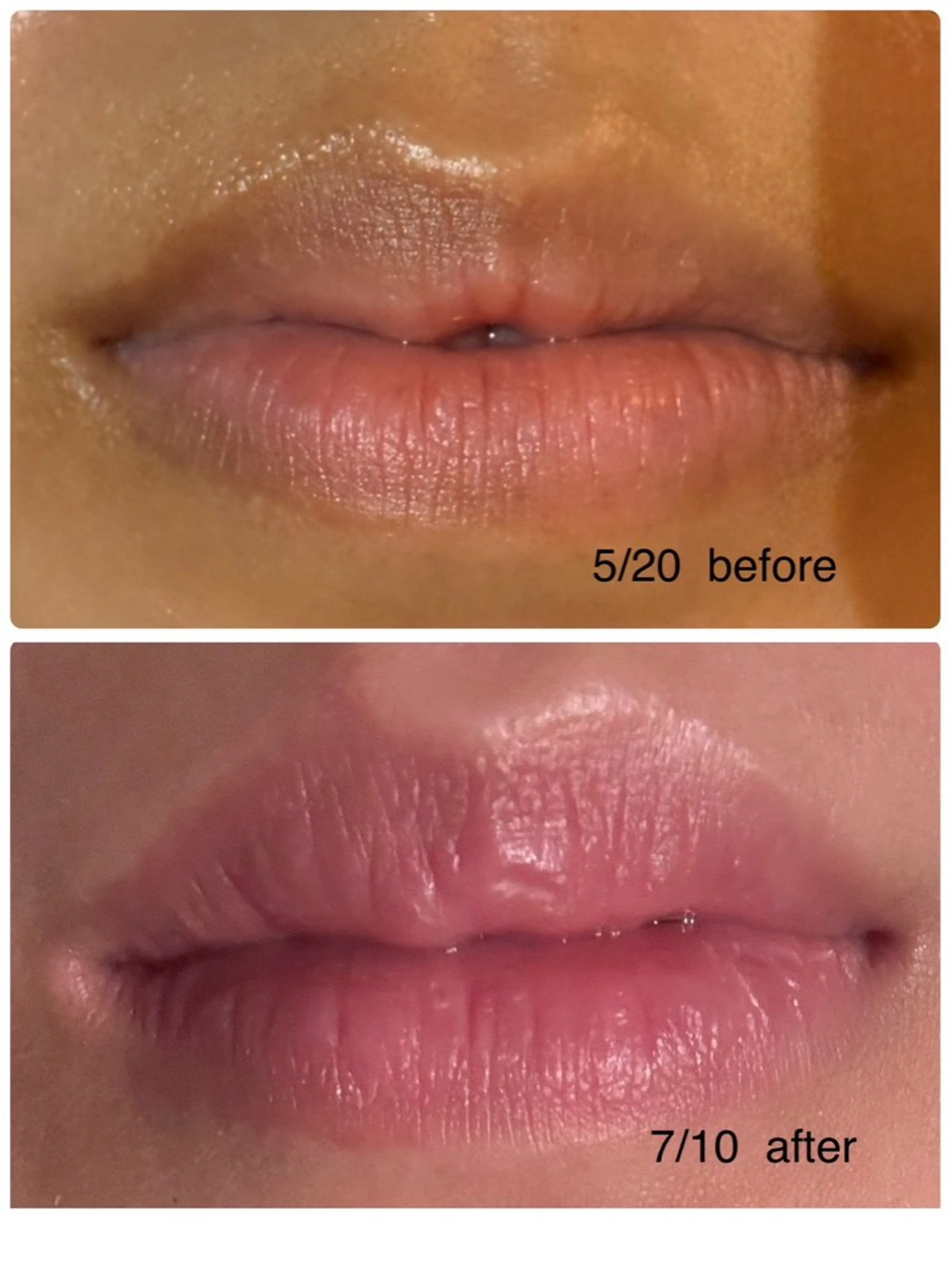 本気で痩せたい方へ 痩身専門サロンのエステ・リラクイメージ