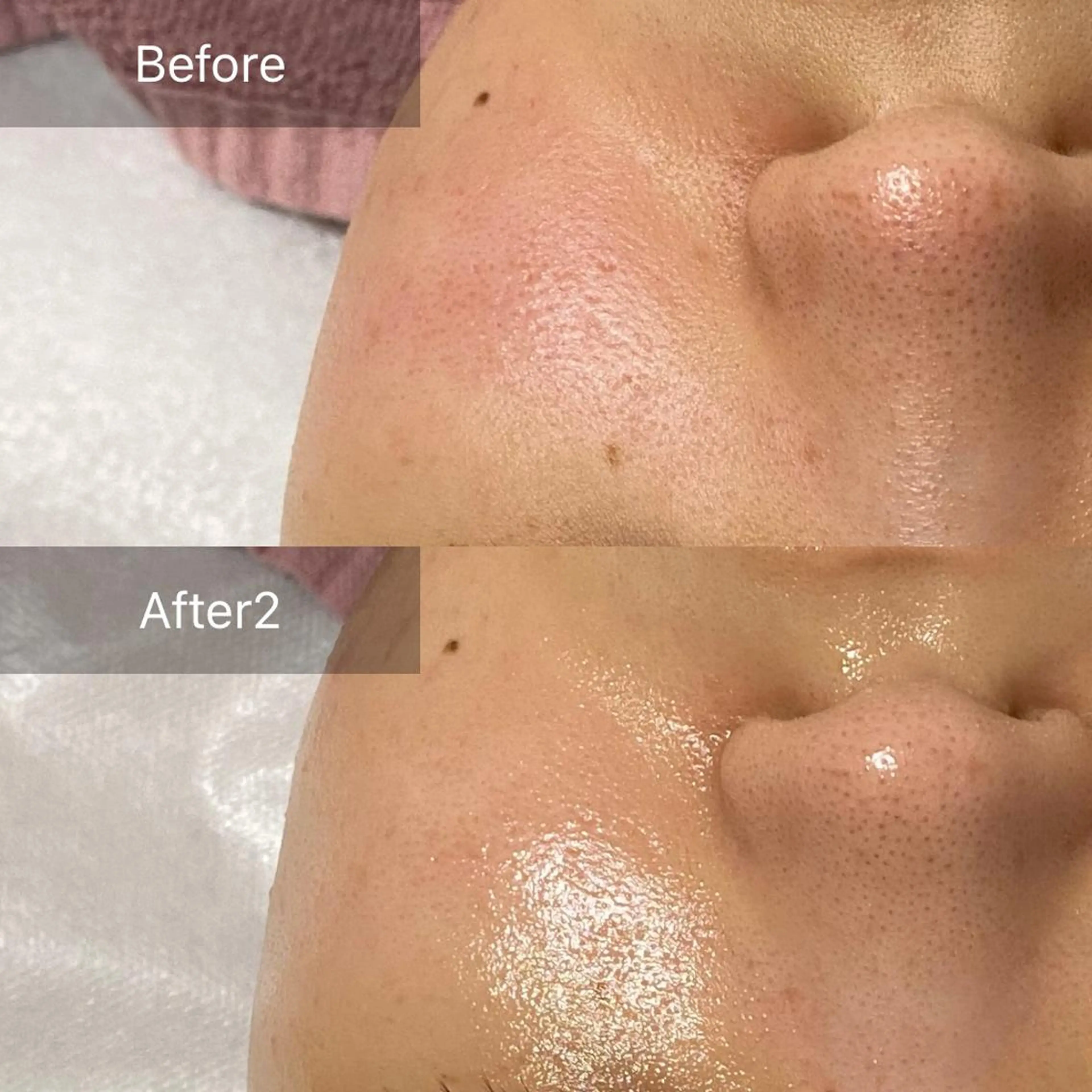 エステ リラク ALIA Scintiller  アリアサンティエ所属・齋藤 祐里耶のエステ・リラクイメージ