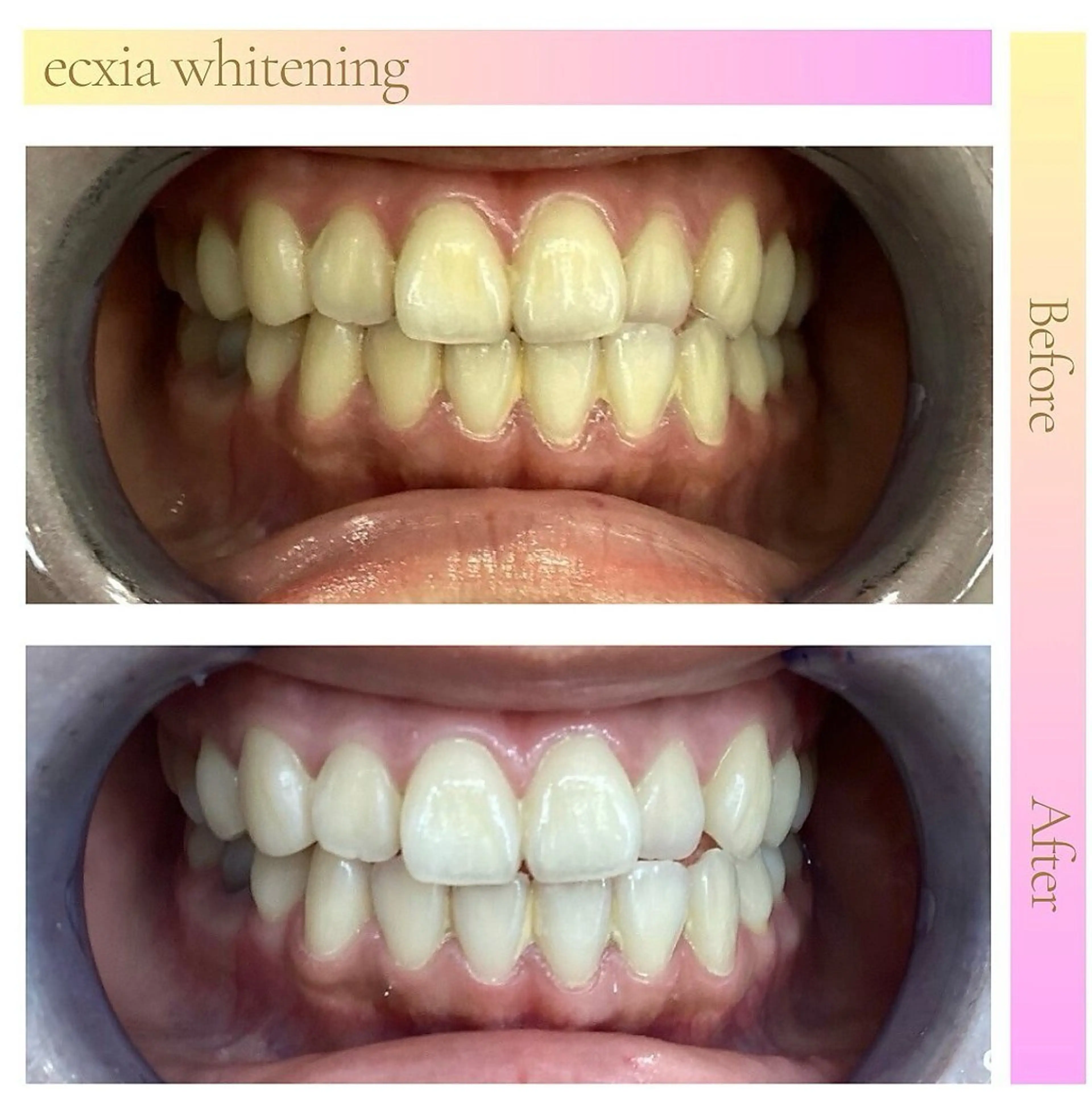 その他 エクシアホワイト 💟fukaのその他イメージ