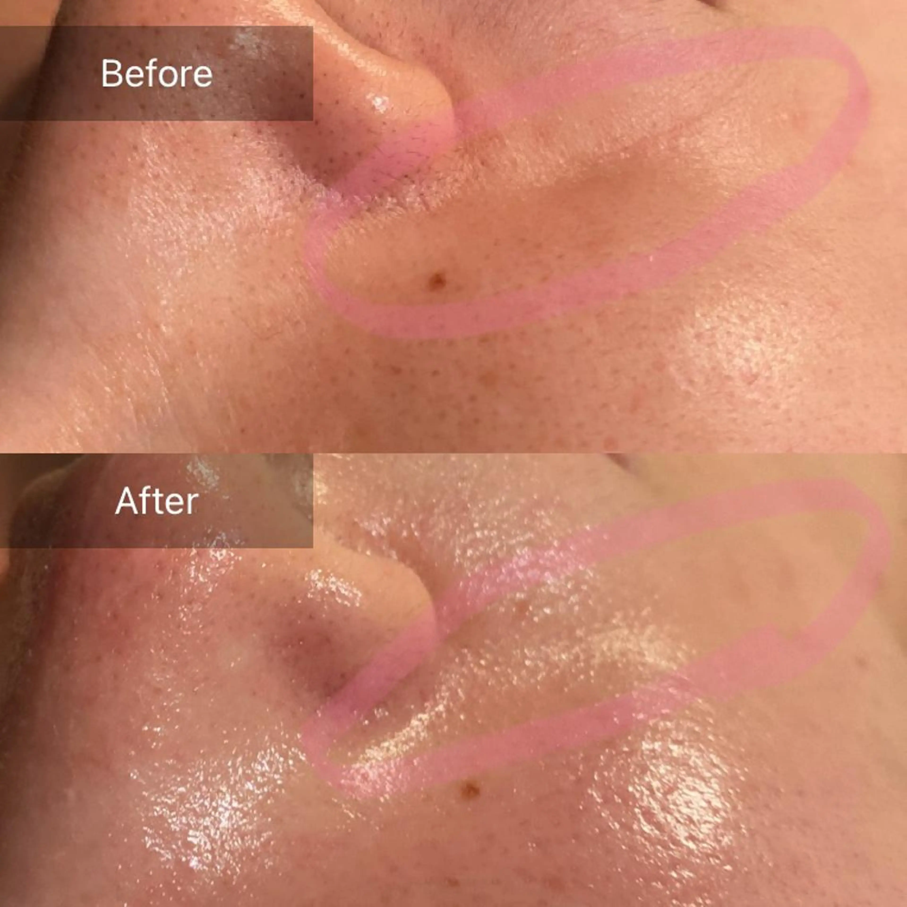 Mandarin Orange所属・毛穴から始める肌メン テマンダリンオレンジのエステ・リラクイメージ