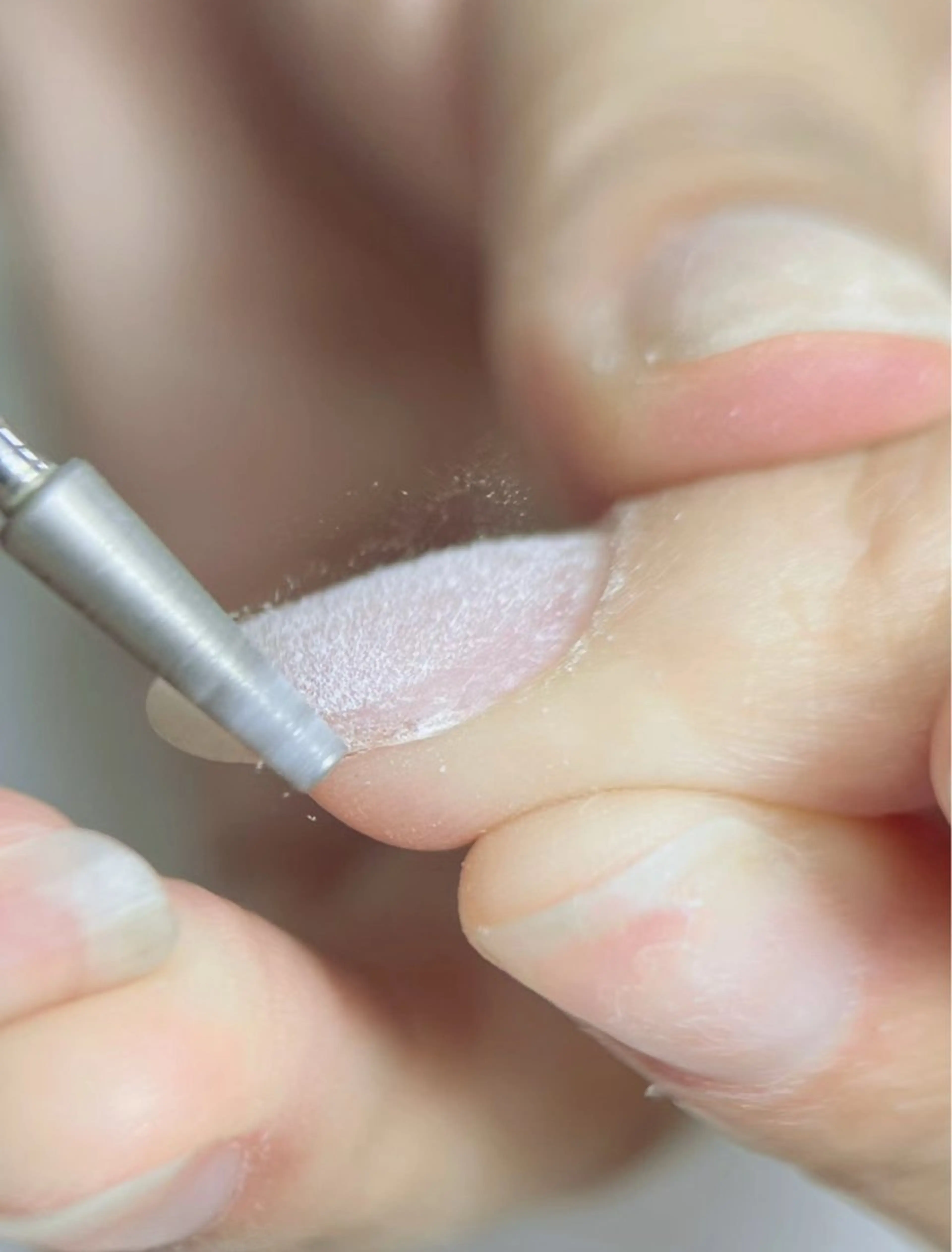 オフのみ(ジェルオフ)3300の写真