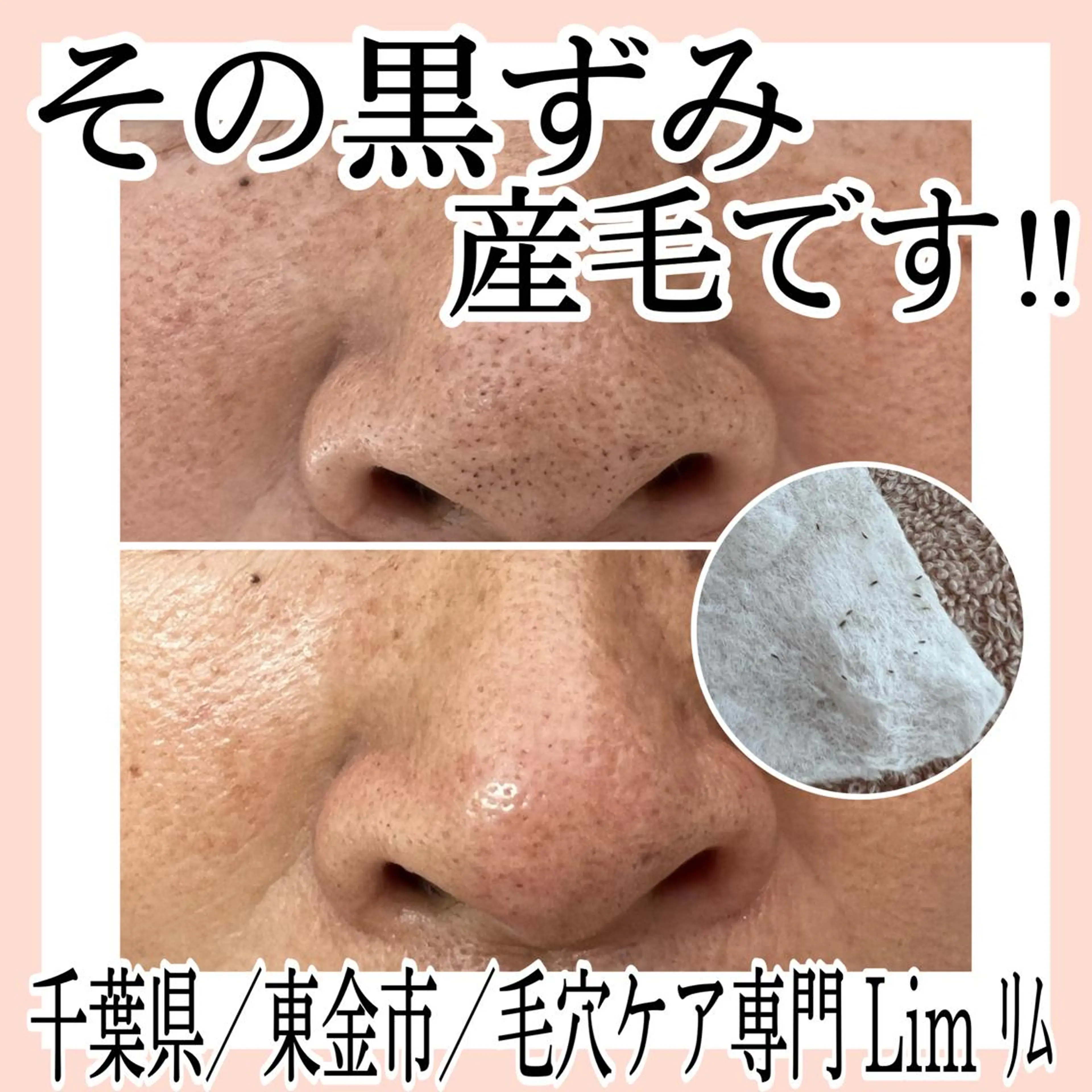 Lim Naomiのマツエク・マツパデザイン