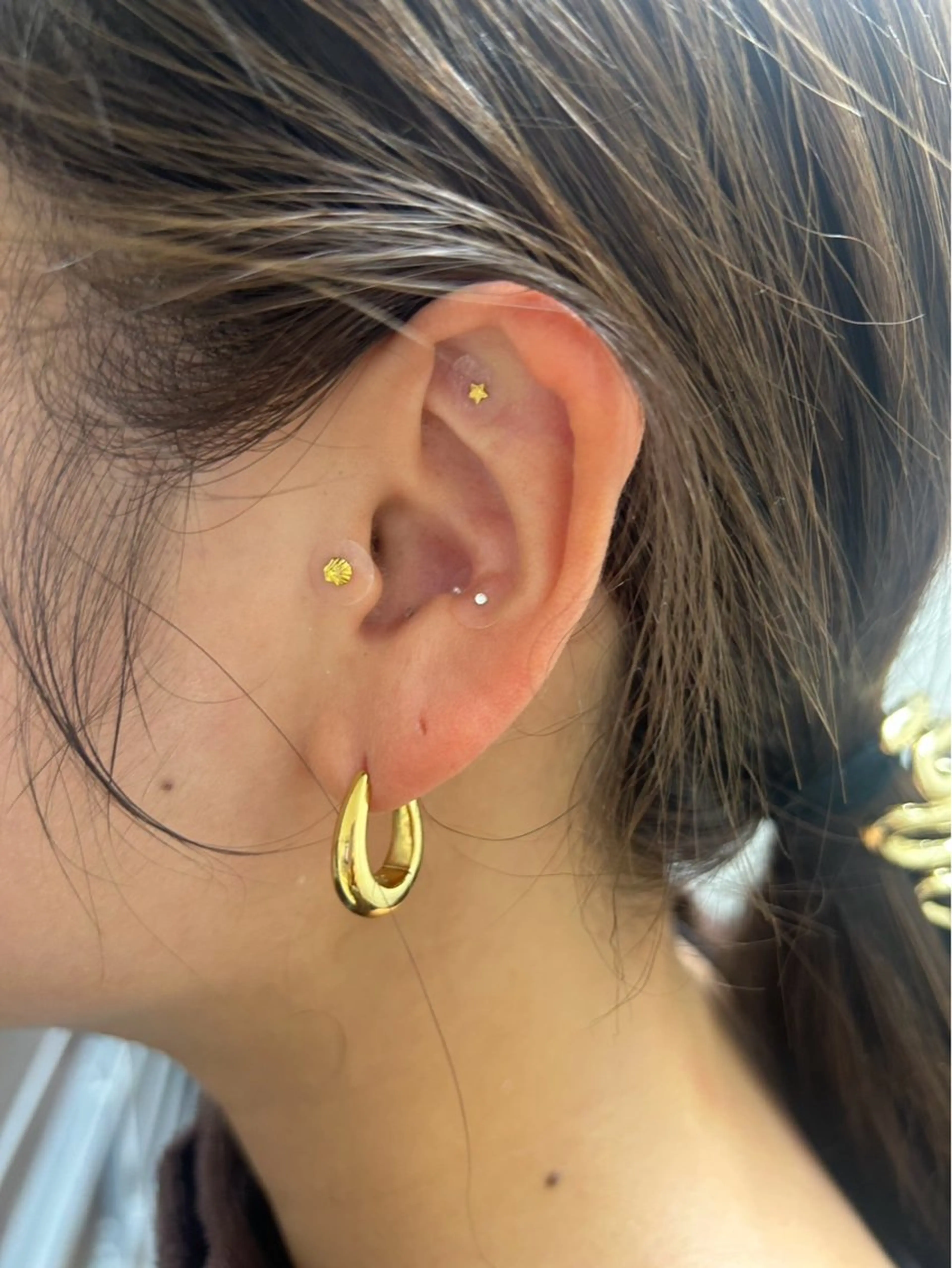 smileskin 京都／meguのその他イメージ