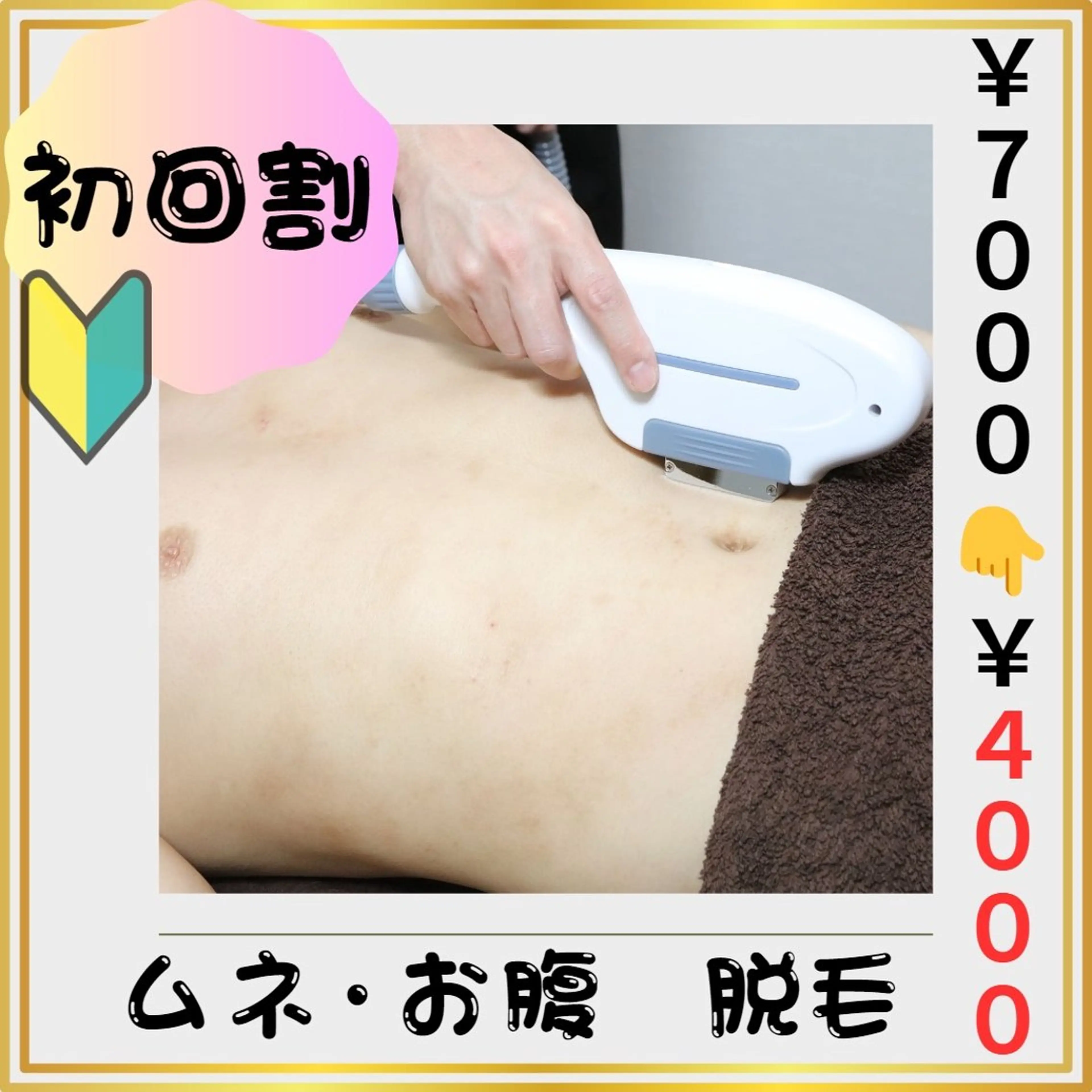 🔰新規割🔰【胸周り・お腹 脱毛】 4️⃣3️⃣%割引❗️(#メンズ脱毛　#清潔感UP　#女性ウケUP  #都度払い)の写真
