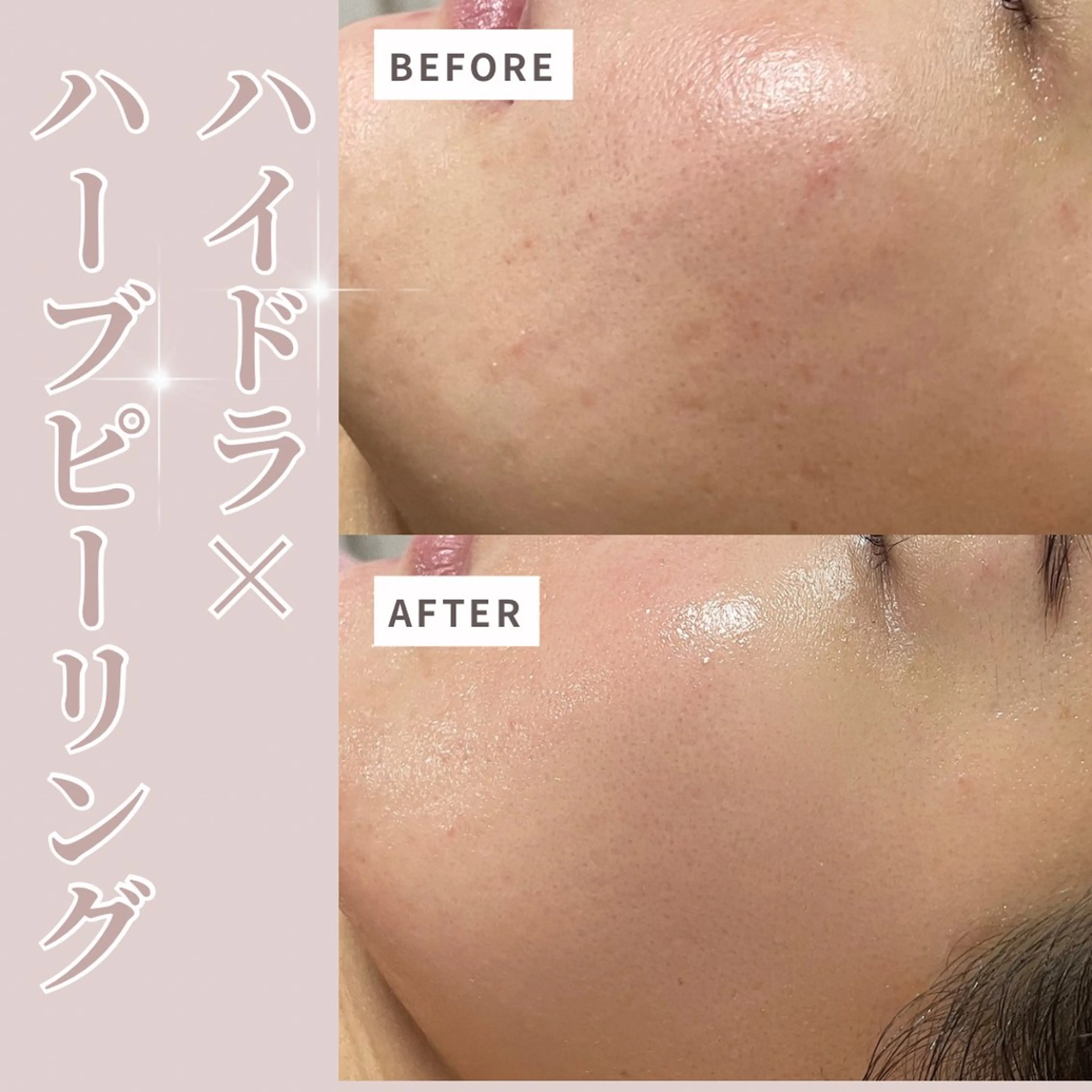 エステ プライベートサロン Belle(ベル)のエステ・リラクイメージ