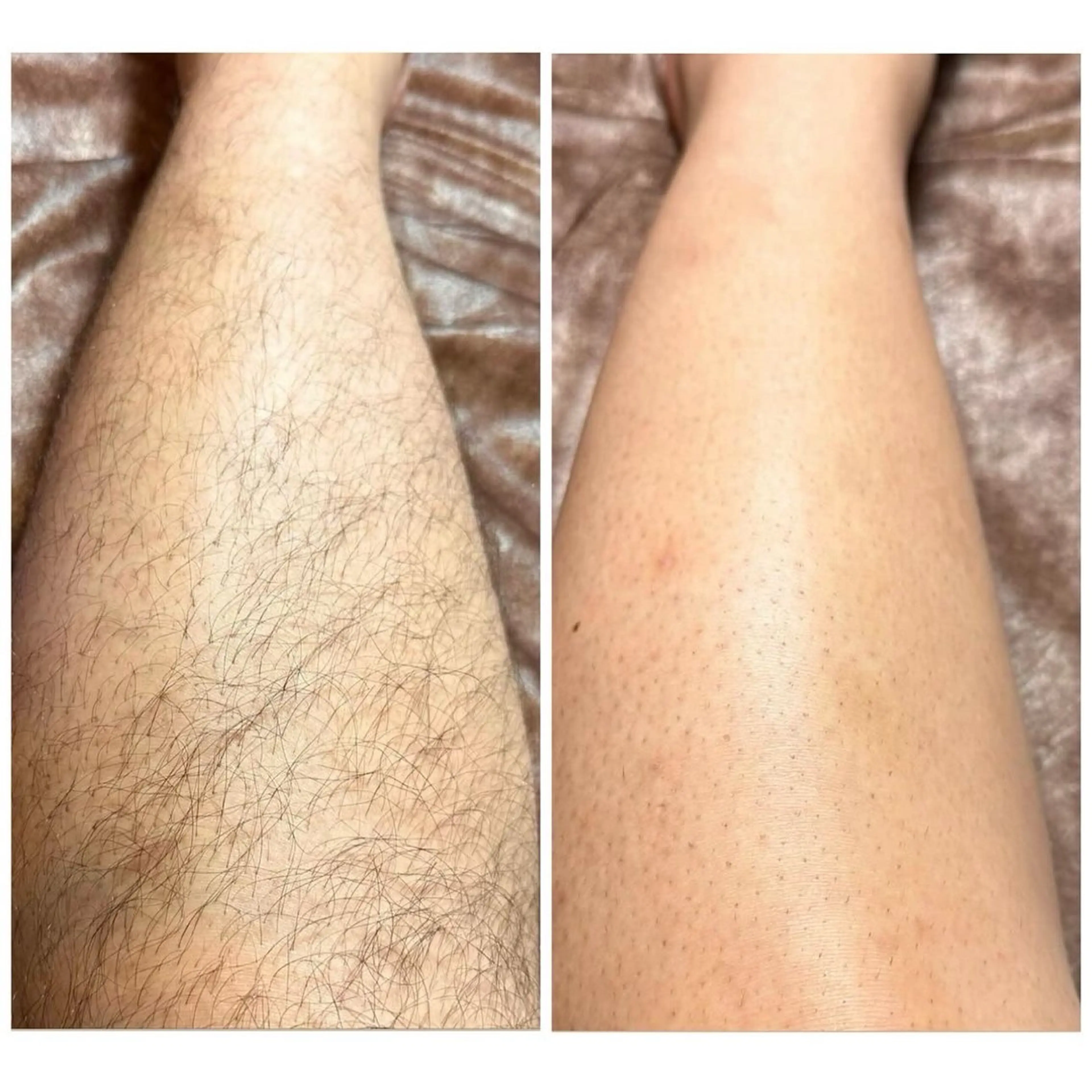 メンズ 脱毛 JOLF salon originalのエステ・リラクイメージ