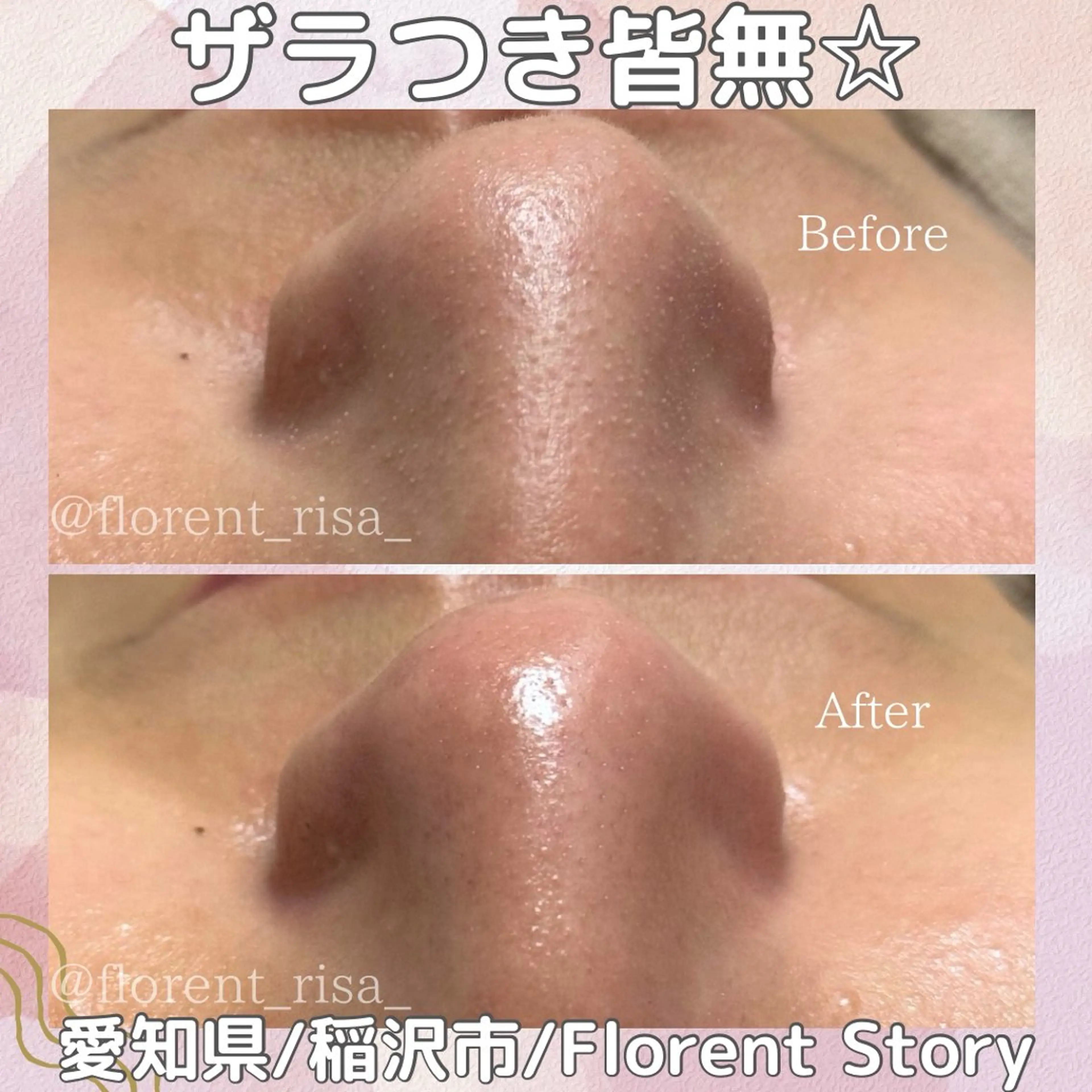 エステ 田中 里沙のエステ・リラクイメージ