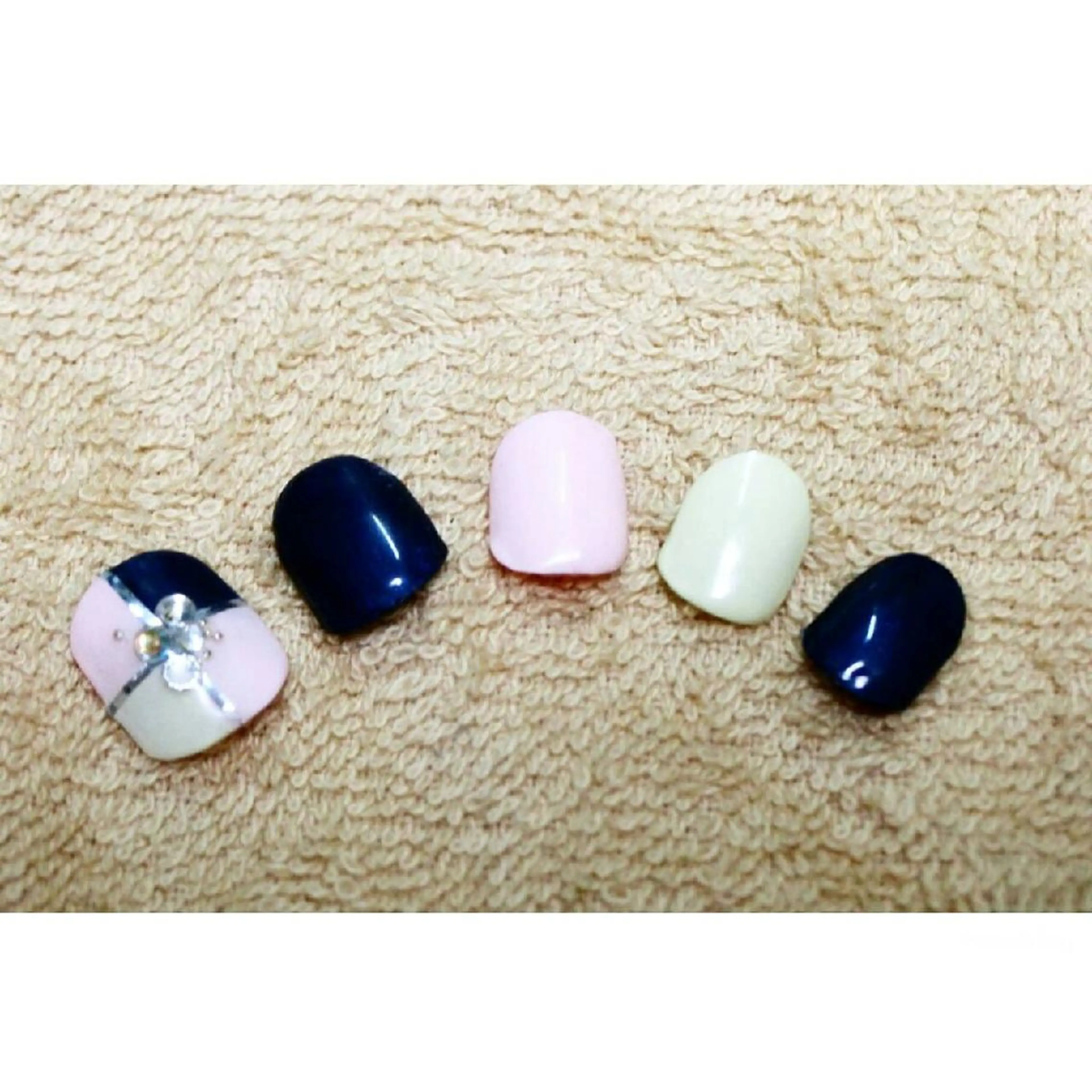 ネイル フットネイル 痛ネイル/ワンホン/ フィルイン/長さだしのネイルデザイン