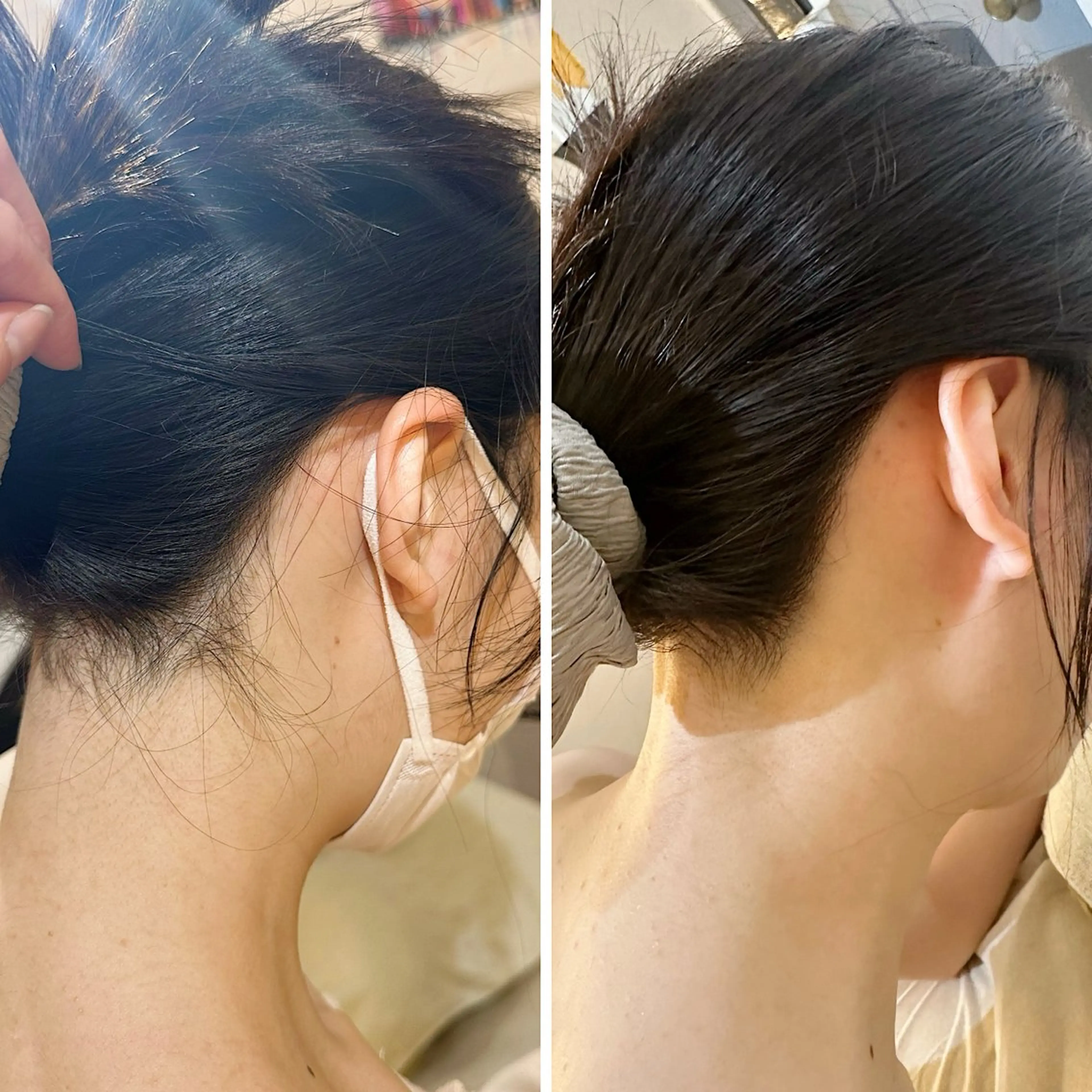 脱毛 うなじ脱毛/美肌脱毛 LABELのエステ・リラクイメージ