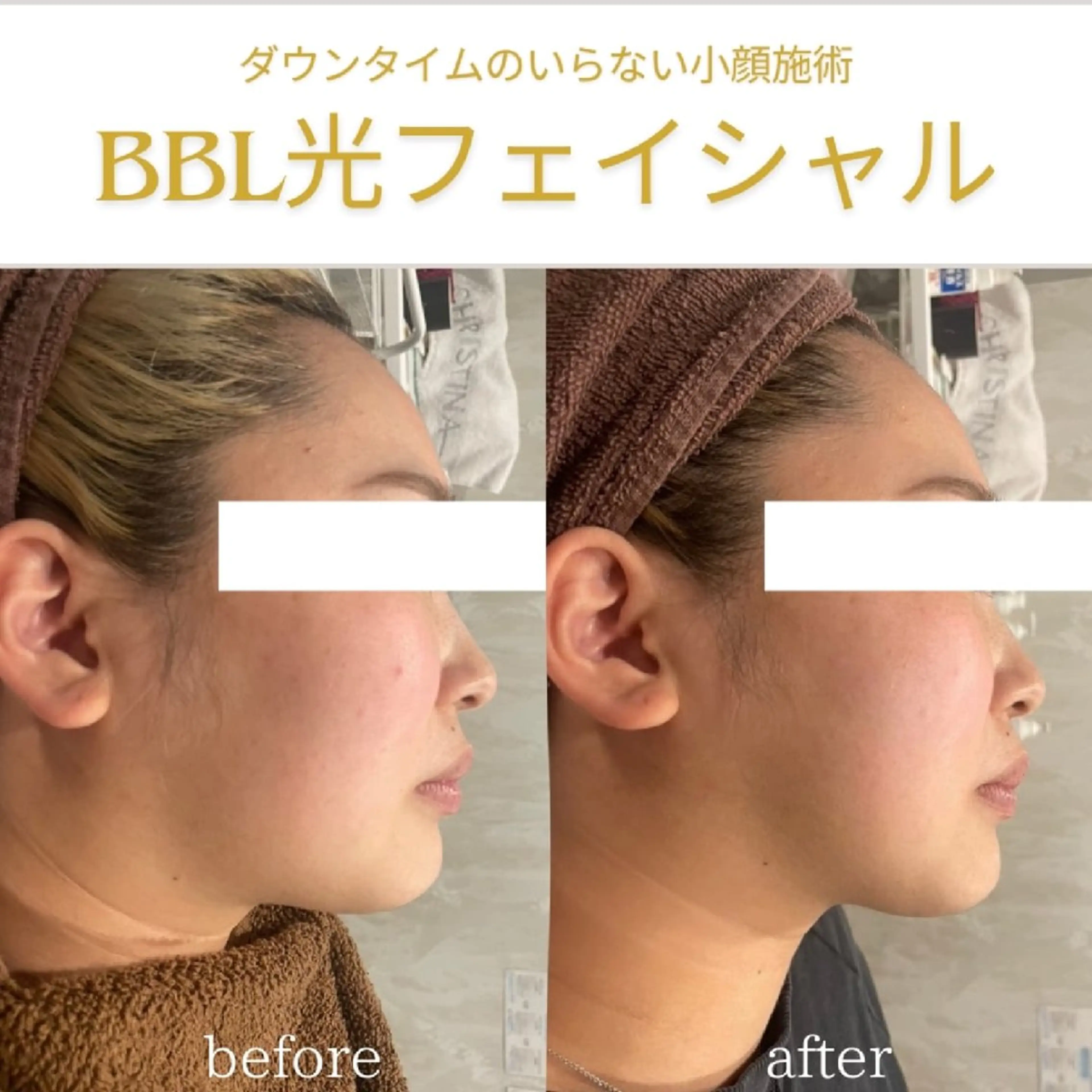 DahliaBeauty ダリアビューティー所属・DahliaBeau tyフェイシャル中村のエステ・リラクイメージ