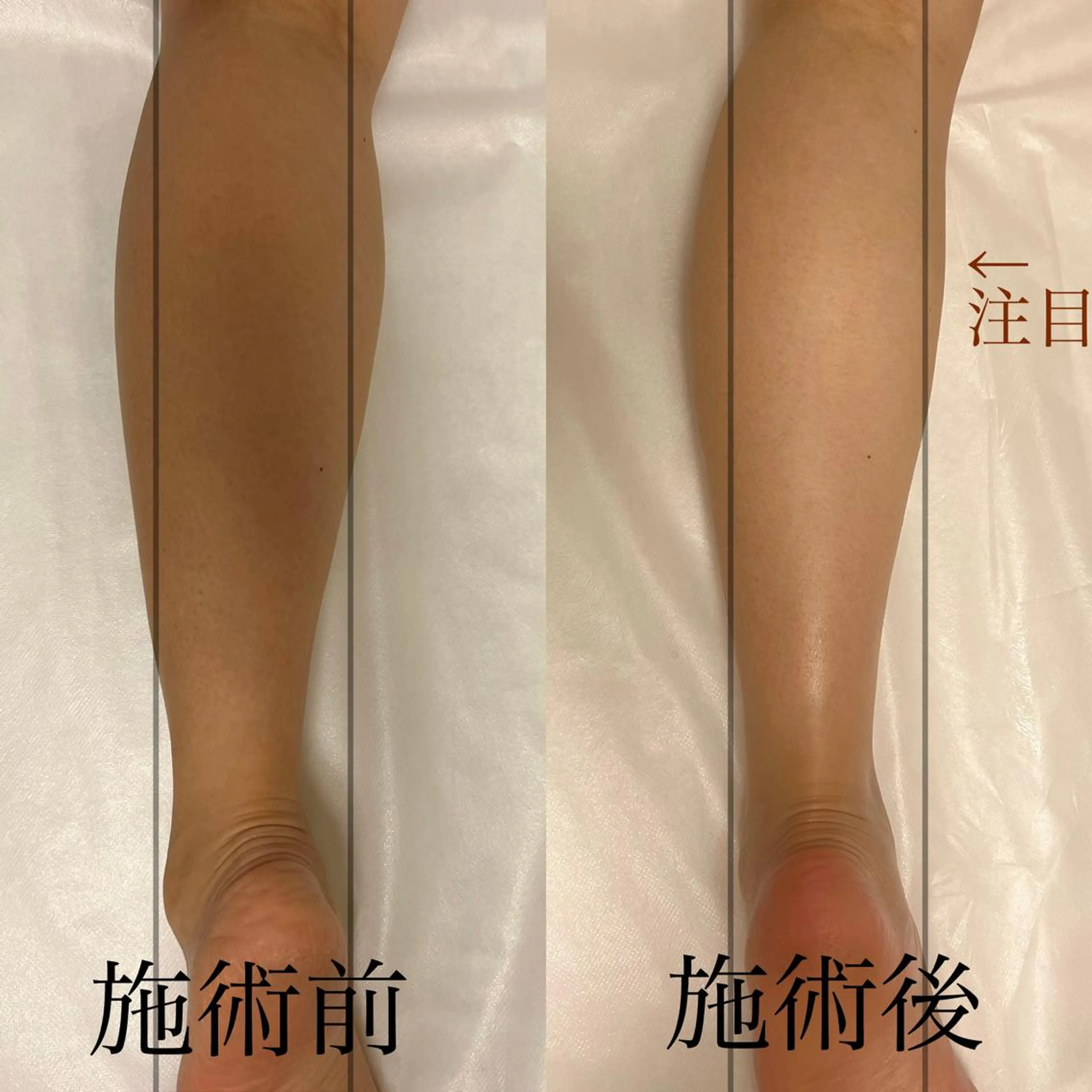 WOM SALON所属・MIKU【美容整形ダ ウンタイムケア銀座】のエステ・リラクイメージ