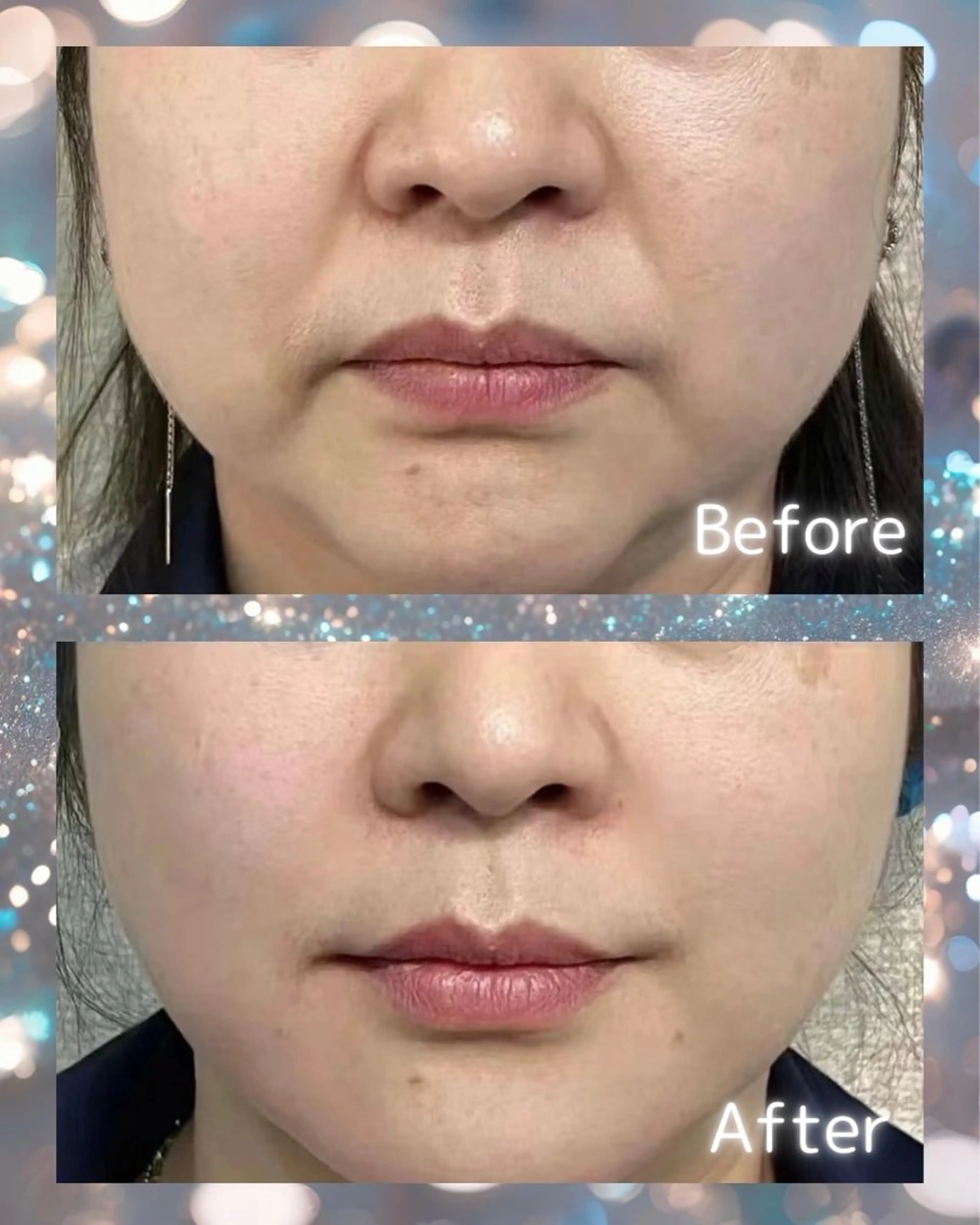 マツエク・マツパ エステ aliaハイフ&水光ジェットサロン所属・aliaハーブ水光店 エステティシャン募集のエステ・リラクイメージ