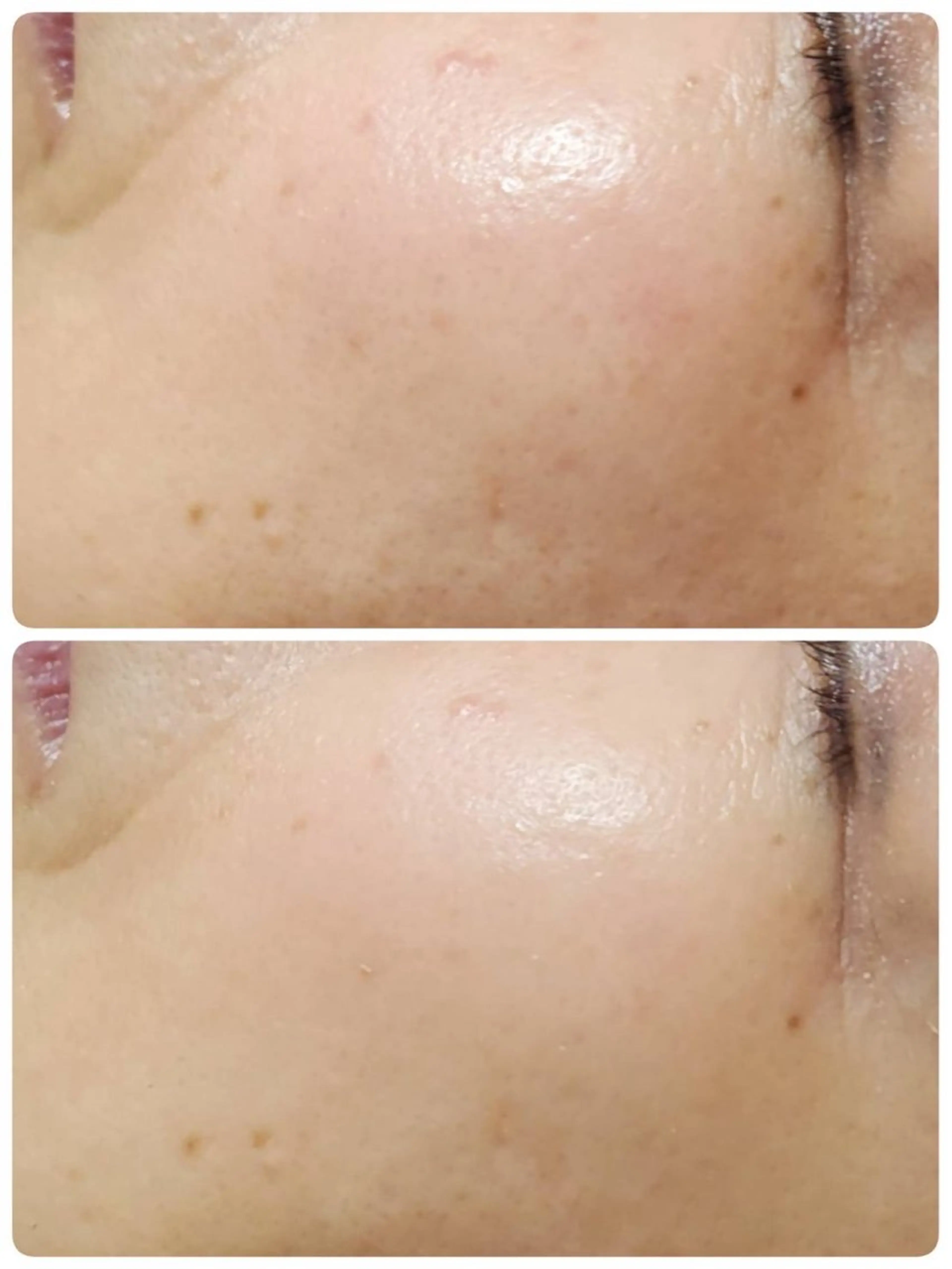 その他 Astorie 相模大野エステのその他イメージ