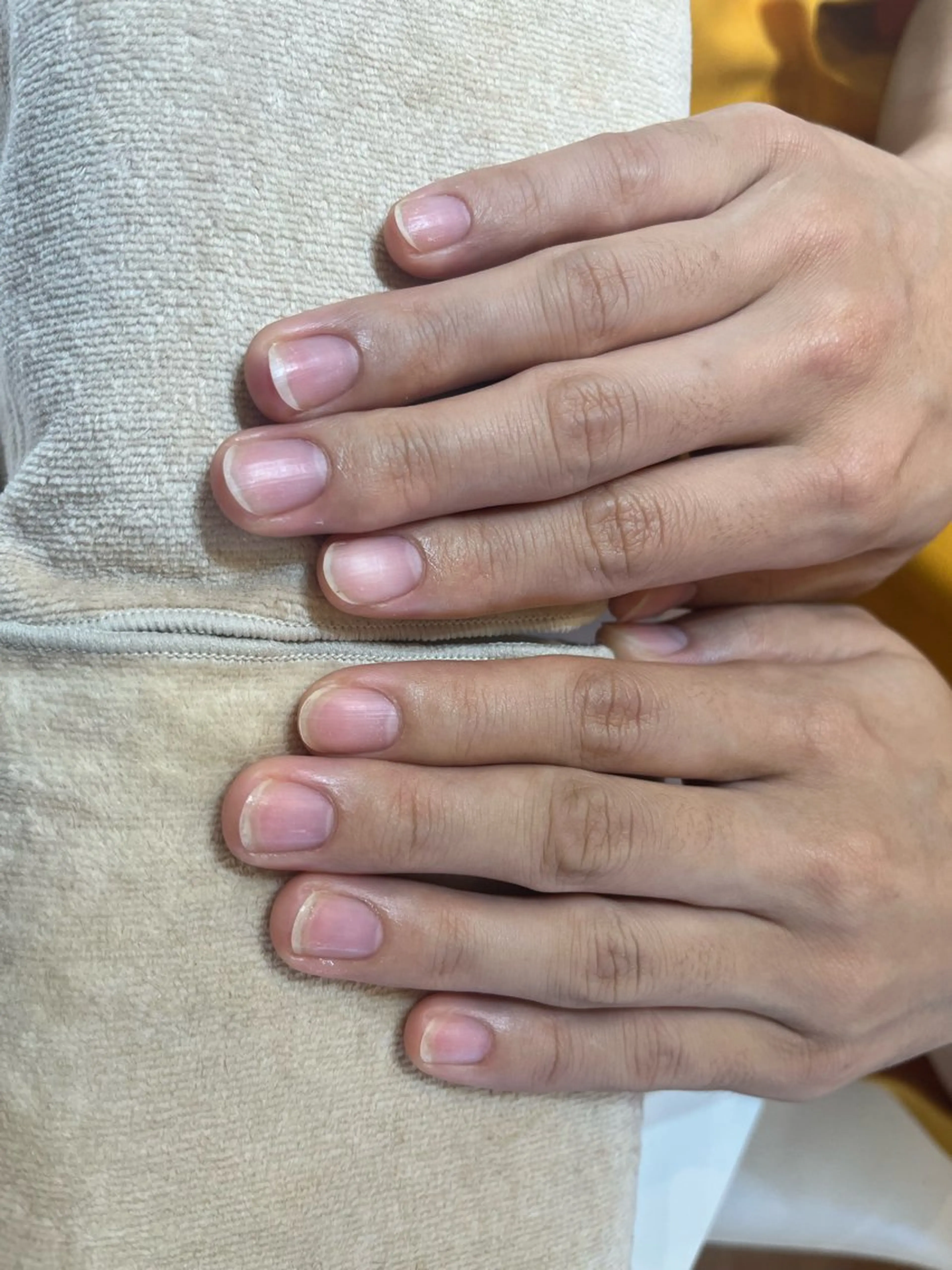 ネイル 近藤 美春のネイルデザイン