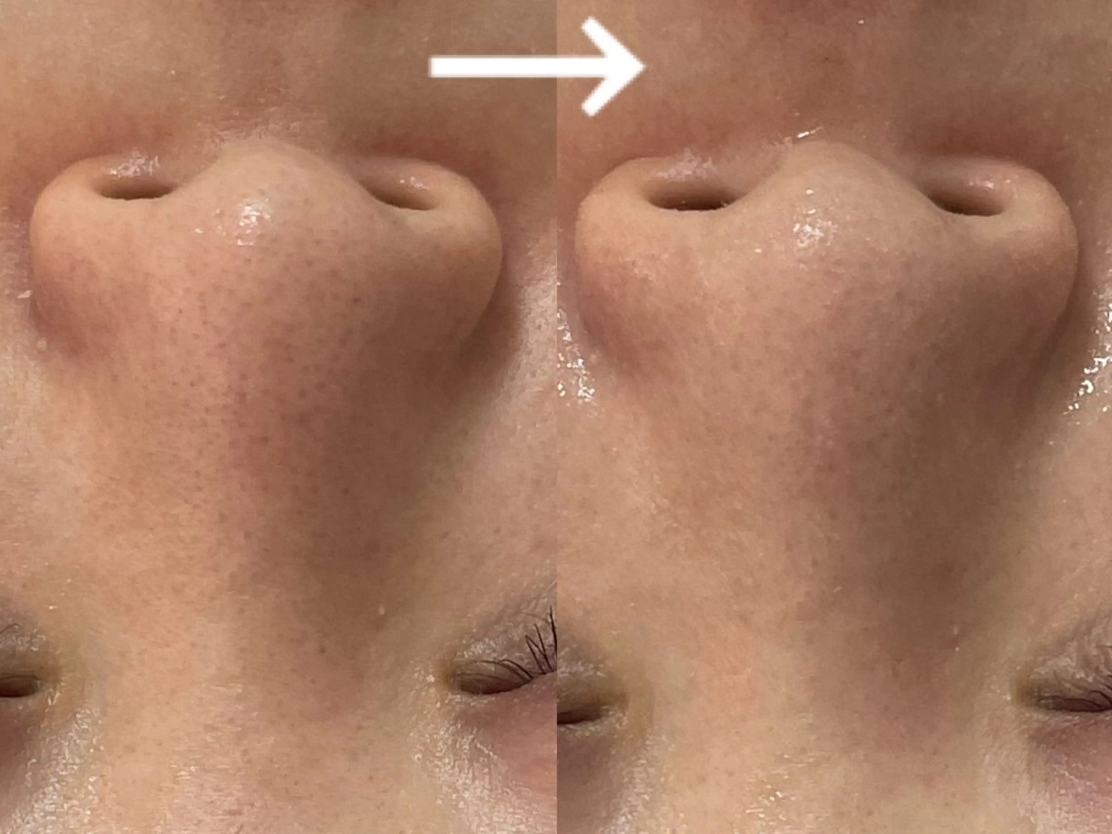 private salon éclat所属・ニキビ・毛穴専門 éclat/エクラのエステ・リラクイメージ