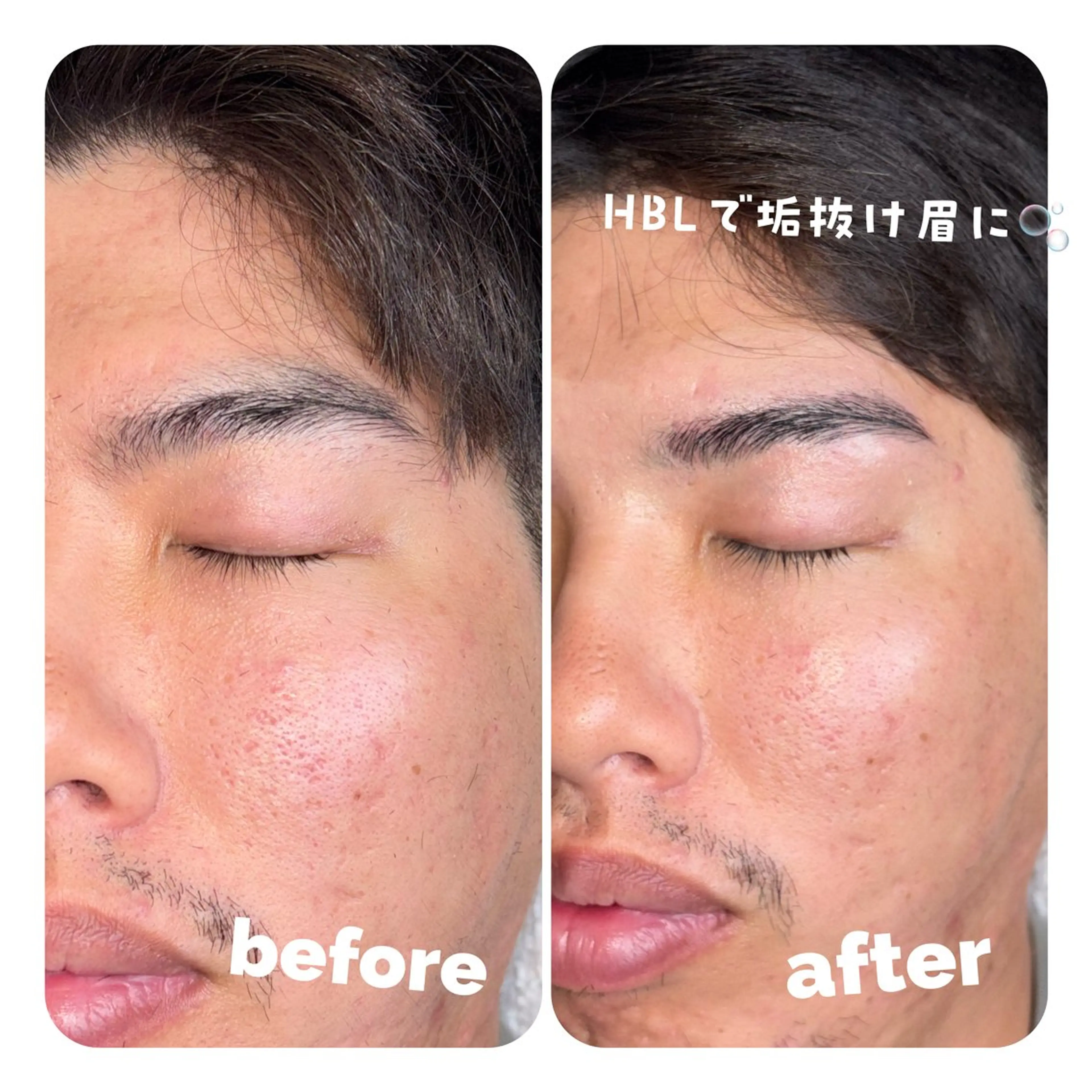 アイブロウ ハリウッドブロウリフト メンズアイブロウ 眉毛ワックス脱毛 LAND🫧🎀 Ayakaの眉毛・アイブロウイメージ