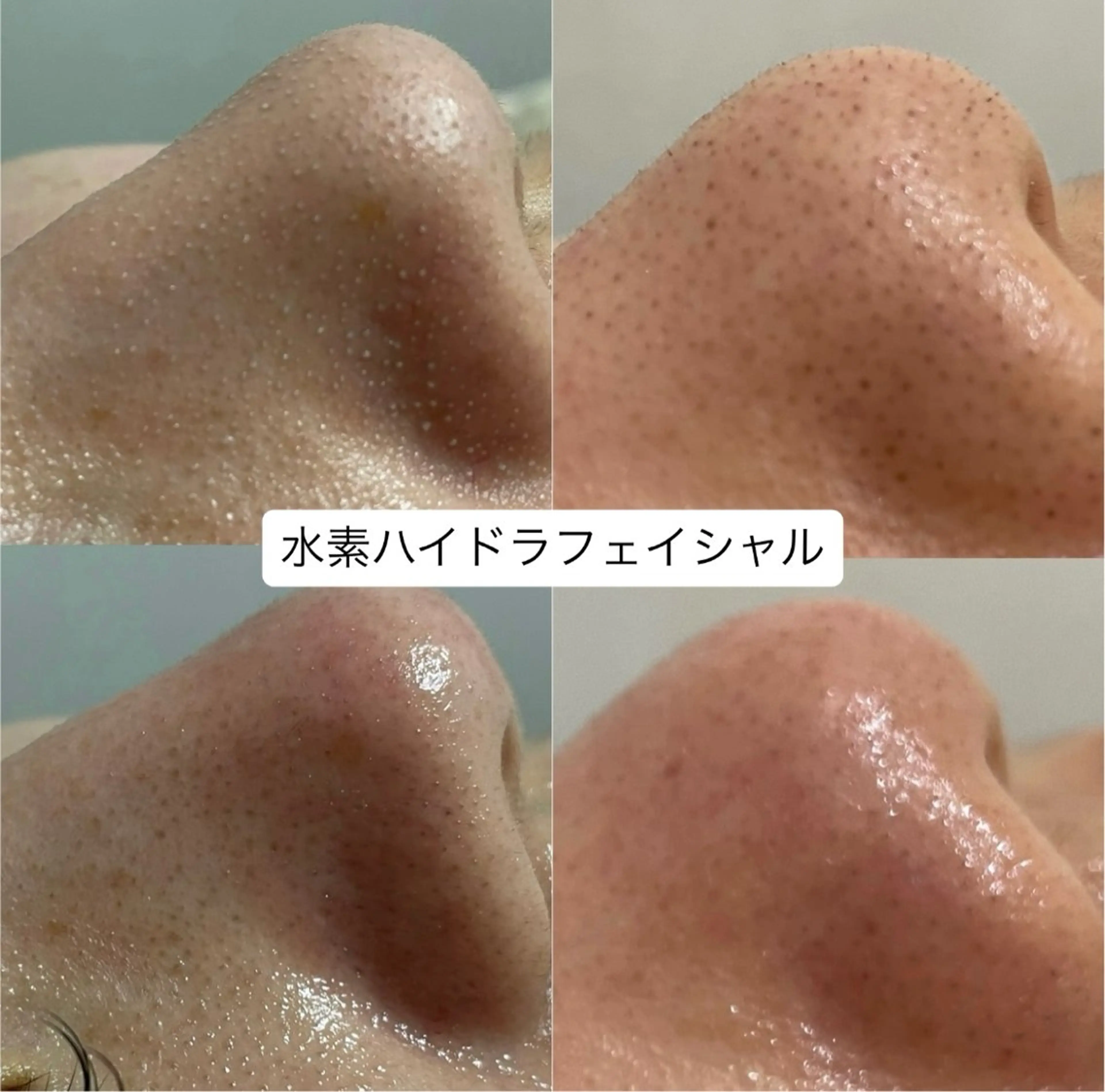 プライベートサロン Belle（ベル）のエステ・リラクイメージ