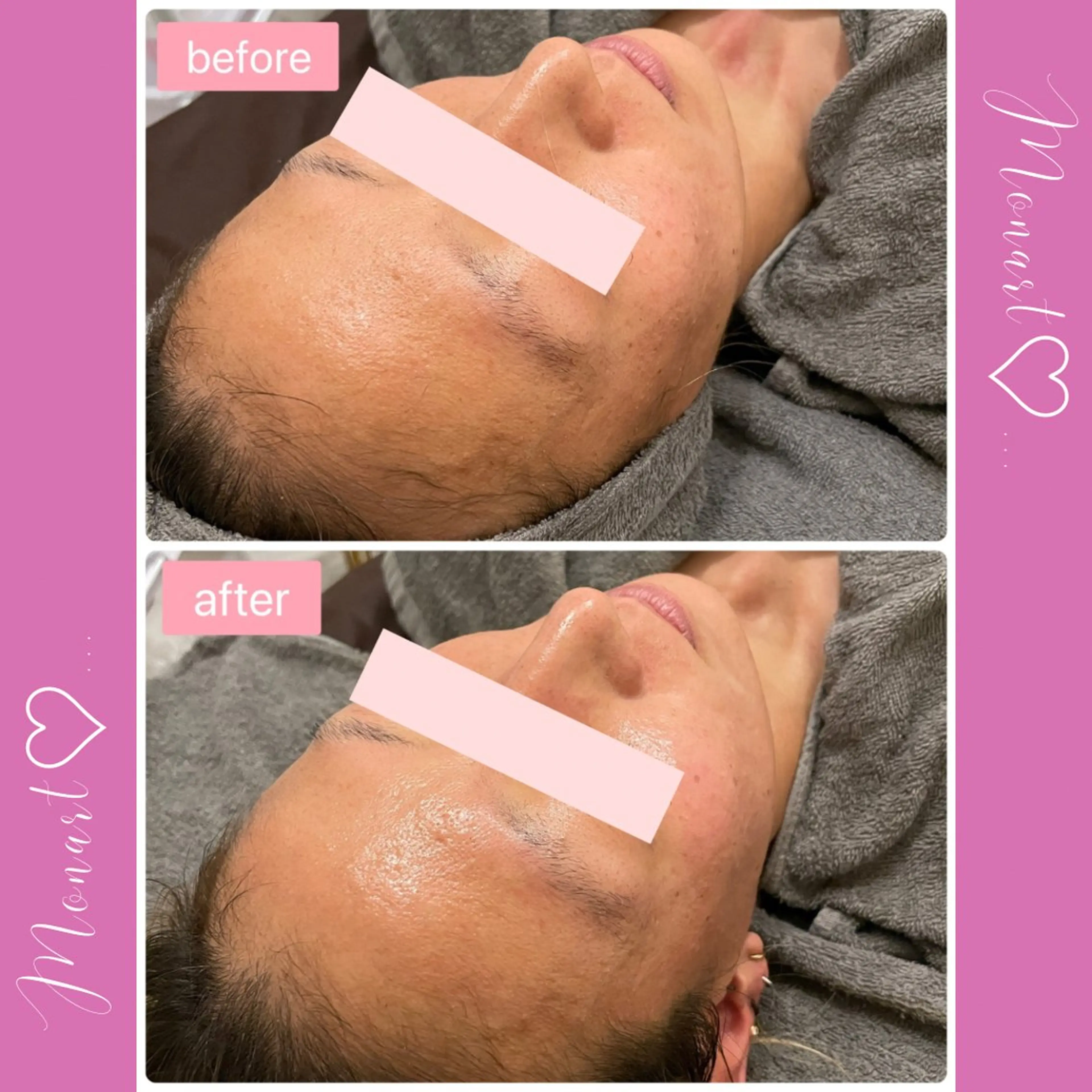 Monart -deux-のエステ・リラクイメージ