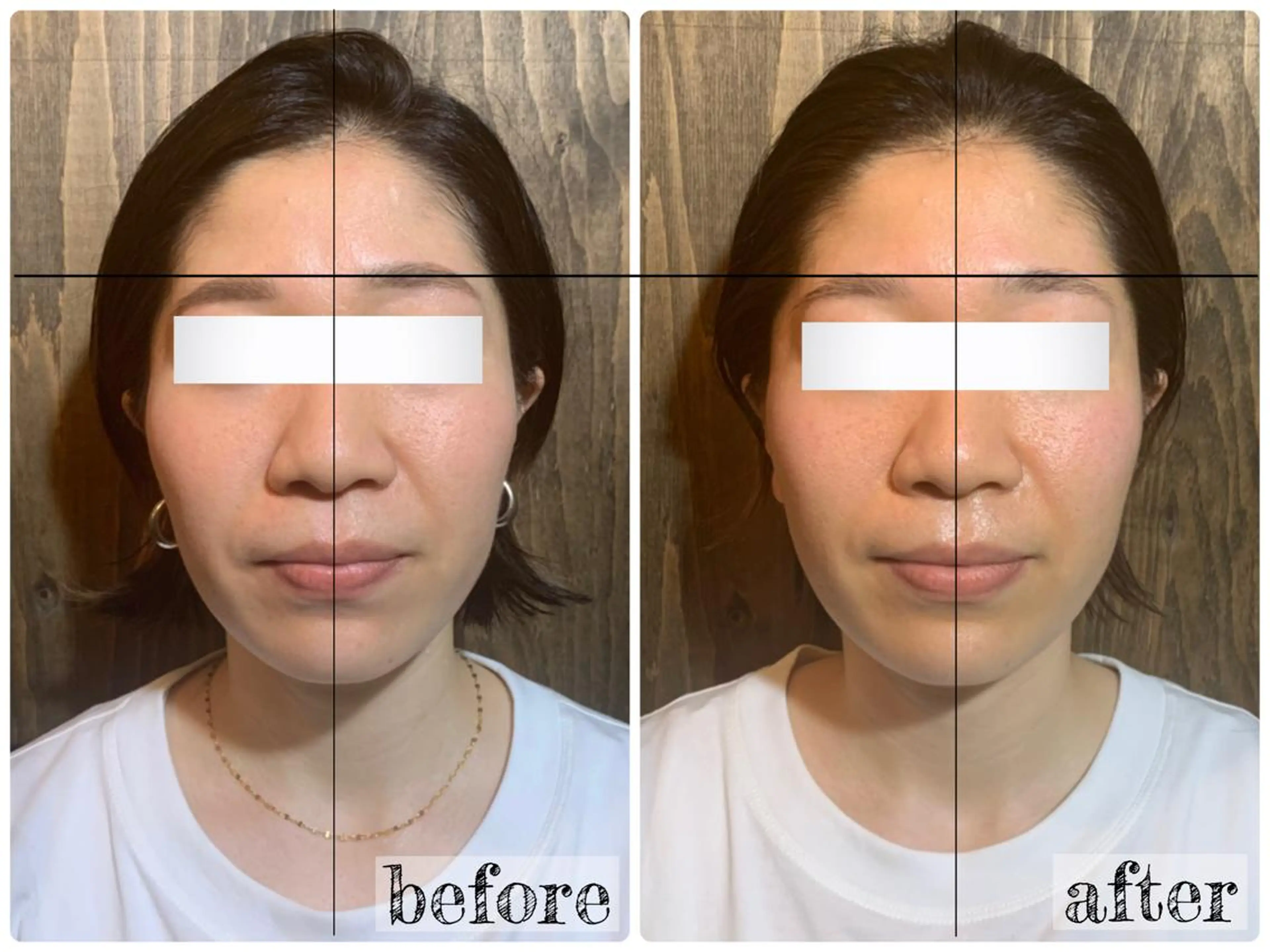 エステ リラク 💎後悔させない小顔 矯正💎イトヤマ🌱のエステ・リラクイメージ