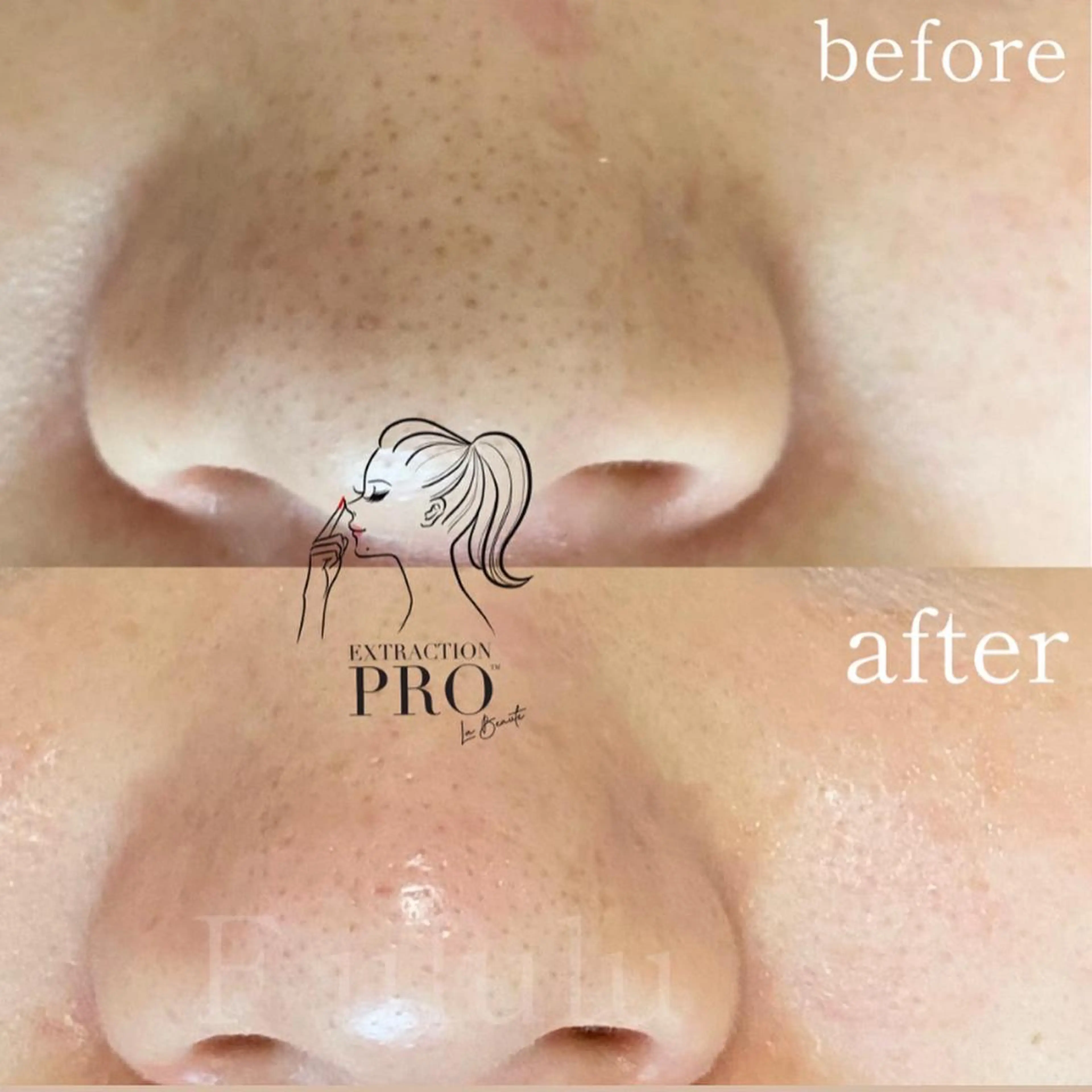 毛穴専門サロン　フルール所属・フルールFululu 自由が丘のエステ・リラクイメージ