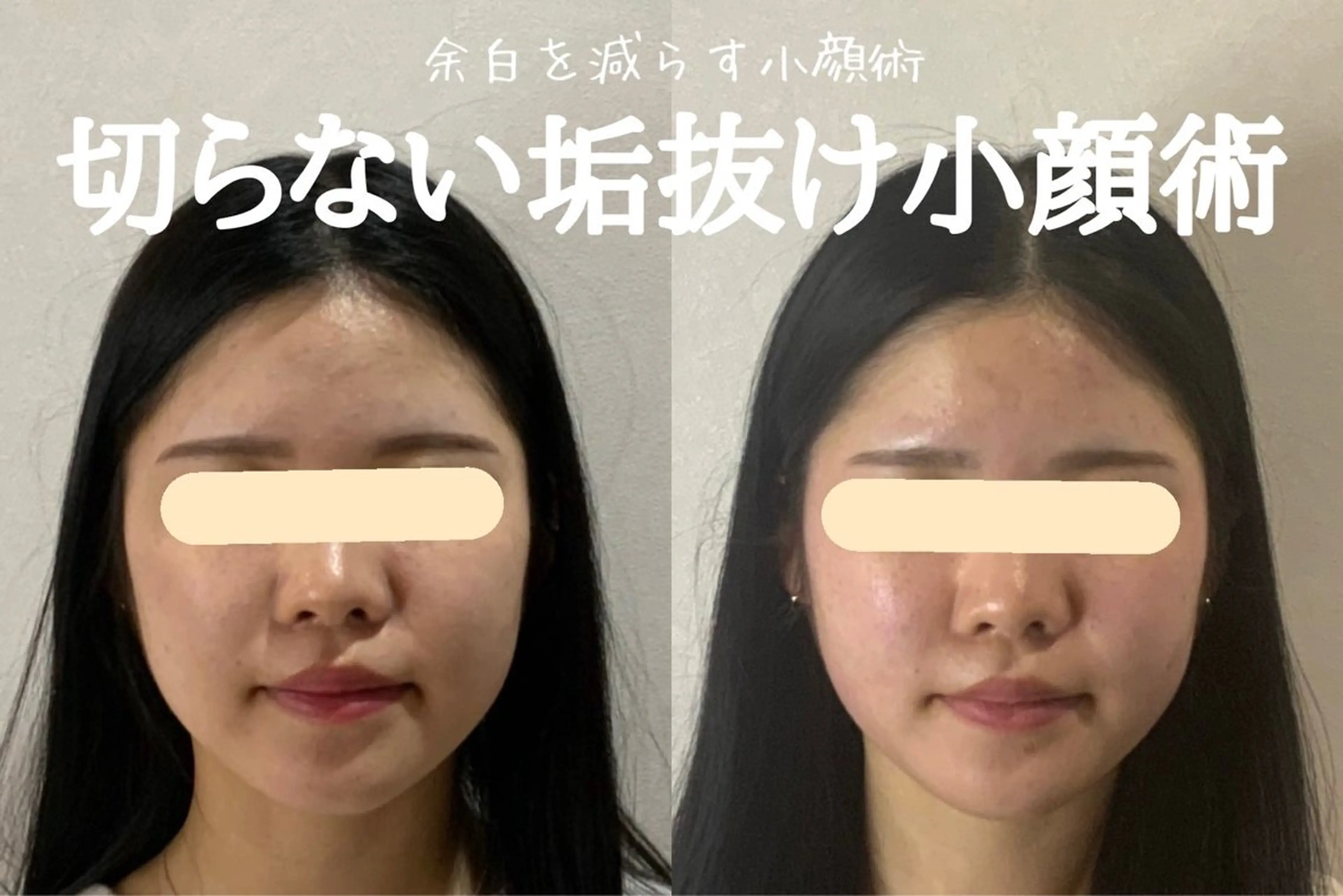 エステ 最速小顔・肌質管理 espoirマキのエステ・リラクイメージ