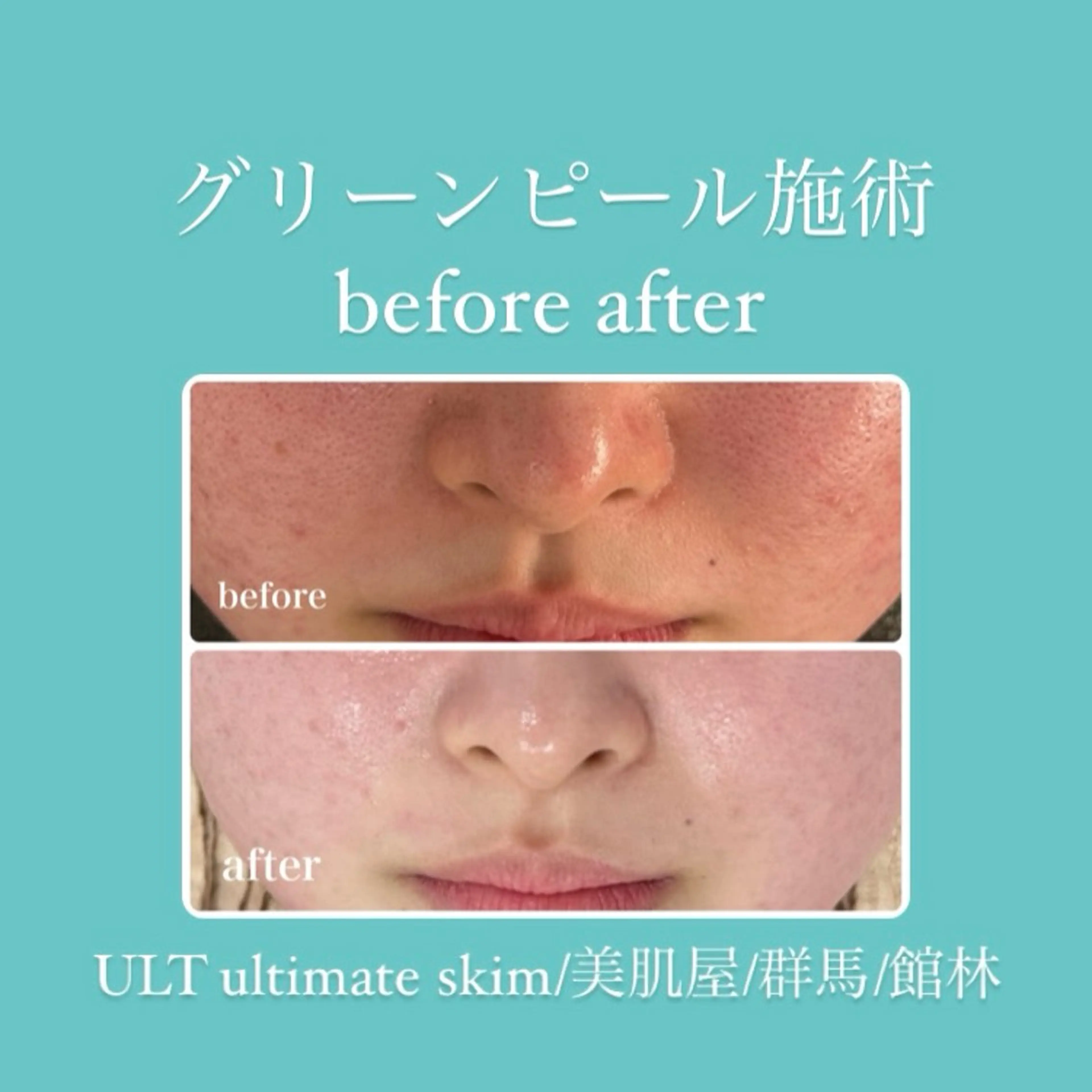 エステ ULT ultimateskin所属・ULT ウルトのエステ・リラクイメージ