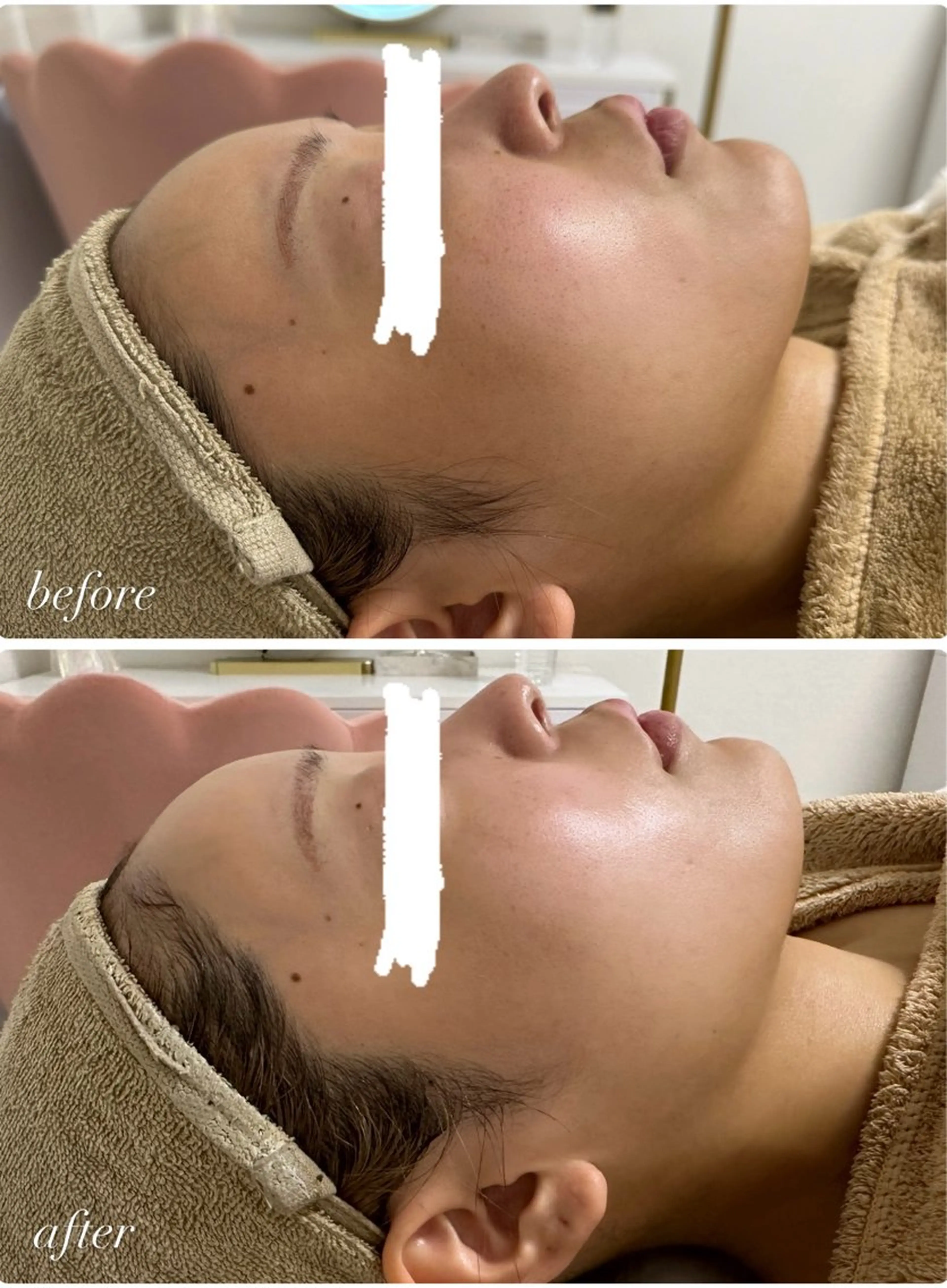 エステ リラク Total beauty salon Remy所属・Remy♡ 石井澪菜のエステ・リラクイメージ