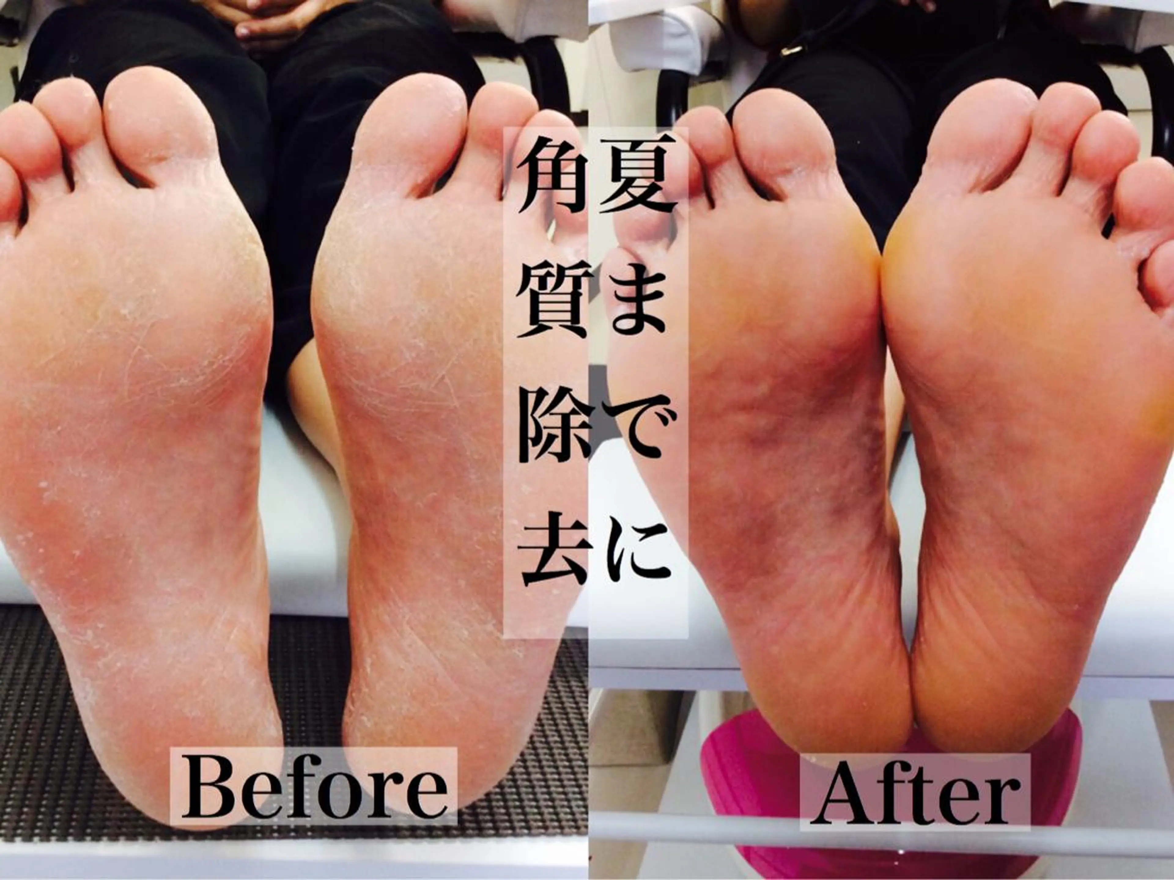 フット角質除去込みワンカラーの写真