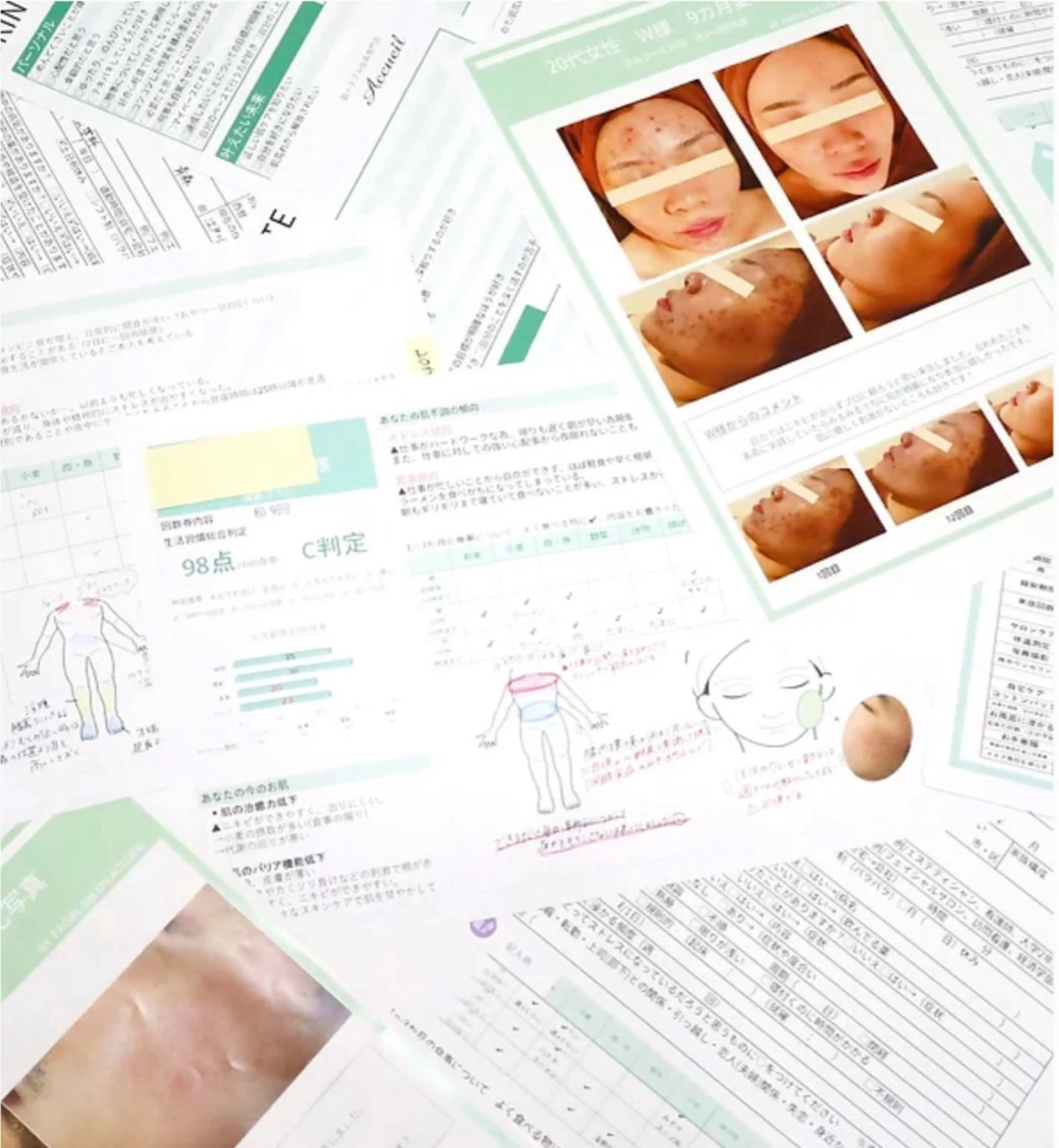 エステ リラク ニキビ跡改善専門🔥 医療にはできない改善のエステ・リラクイメージ