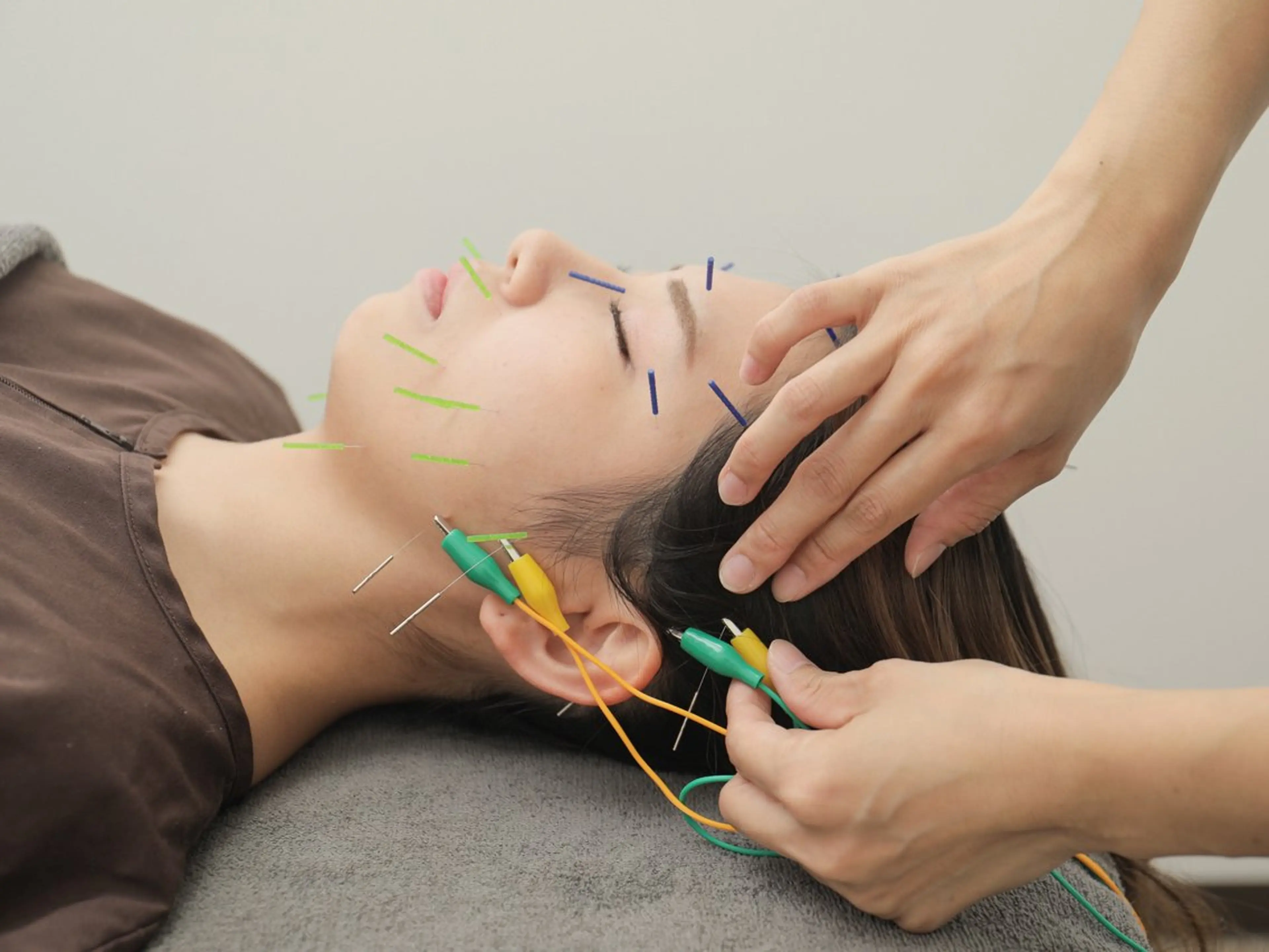 メディカルサロンドオフ所属・ハリサロンドオフ 美容鍼灸×小顔整体のエステ・リラクイメージ